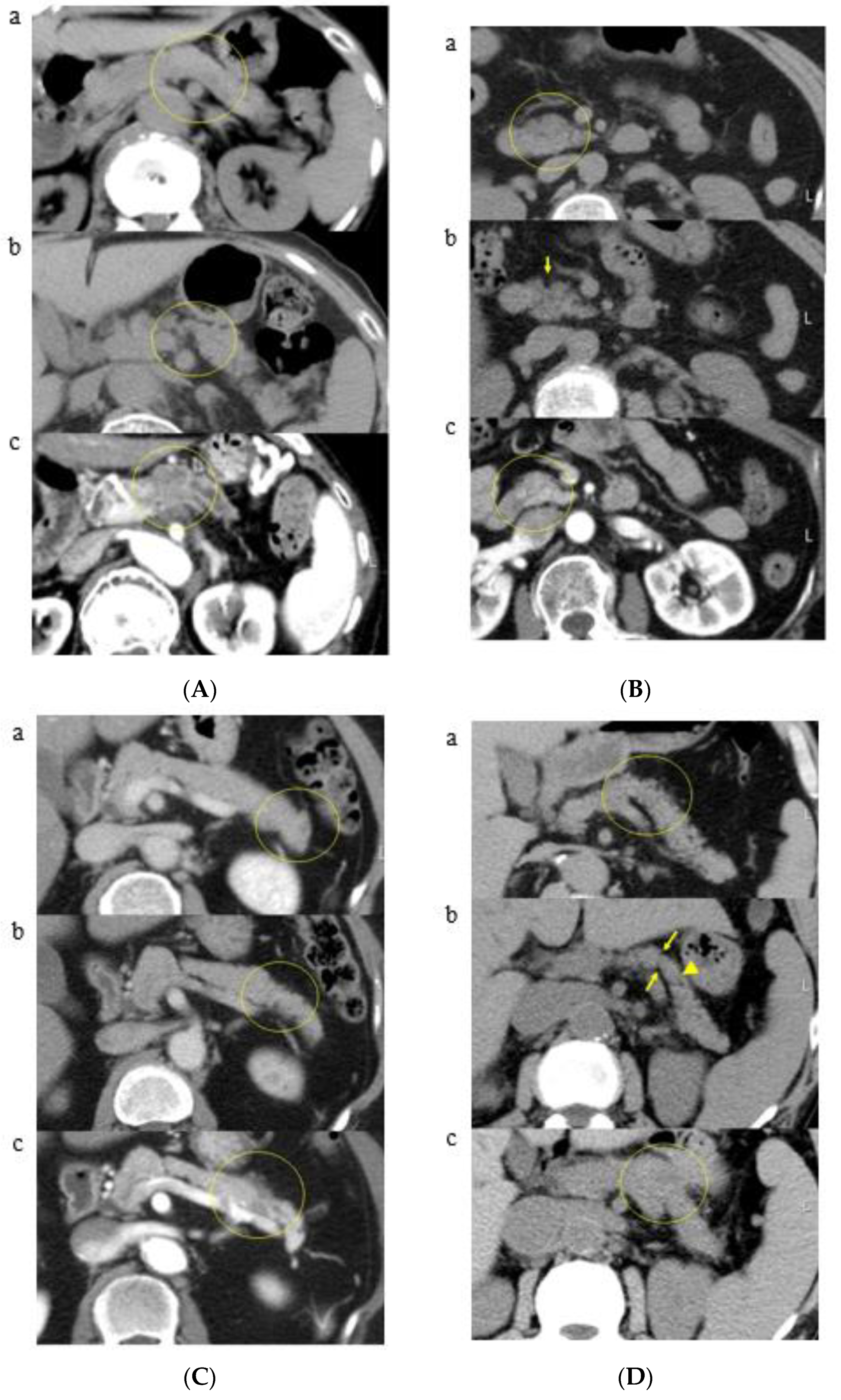 Cancers 13 04222 g004