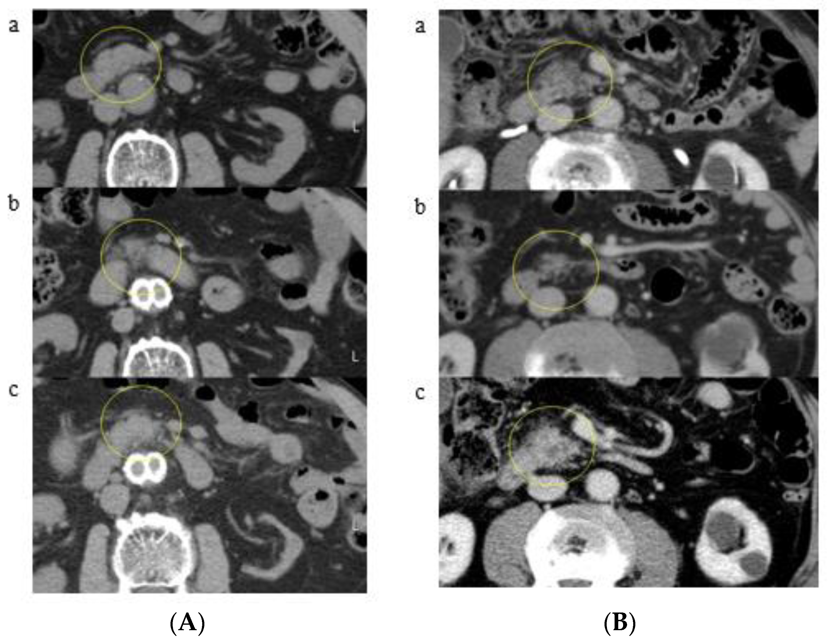 Cancers 13 04222 g005