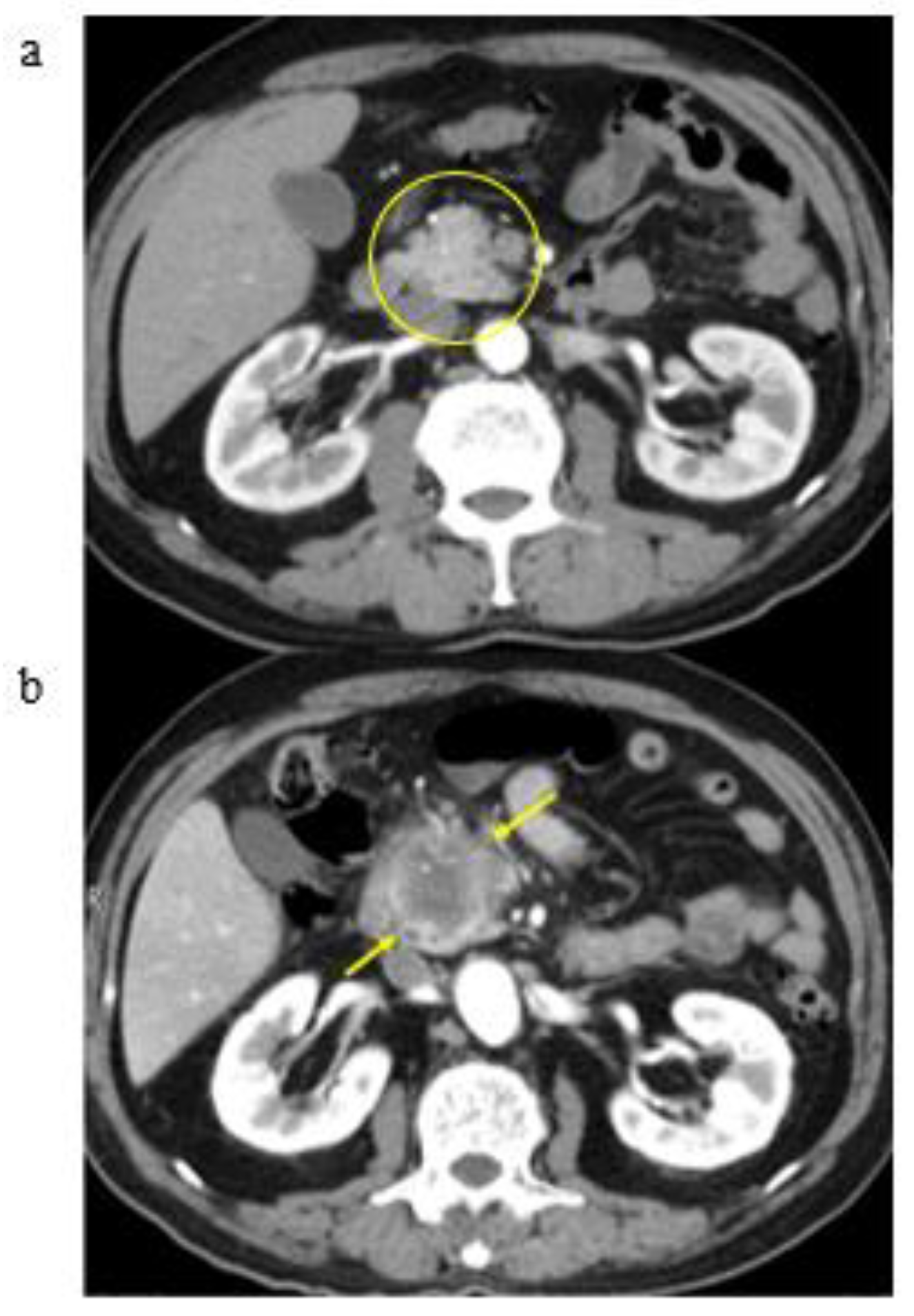 Cancers 13 04222 g006