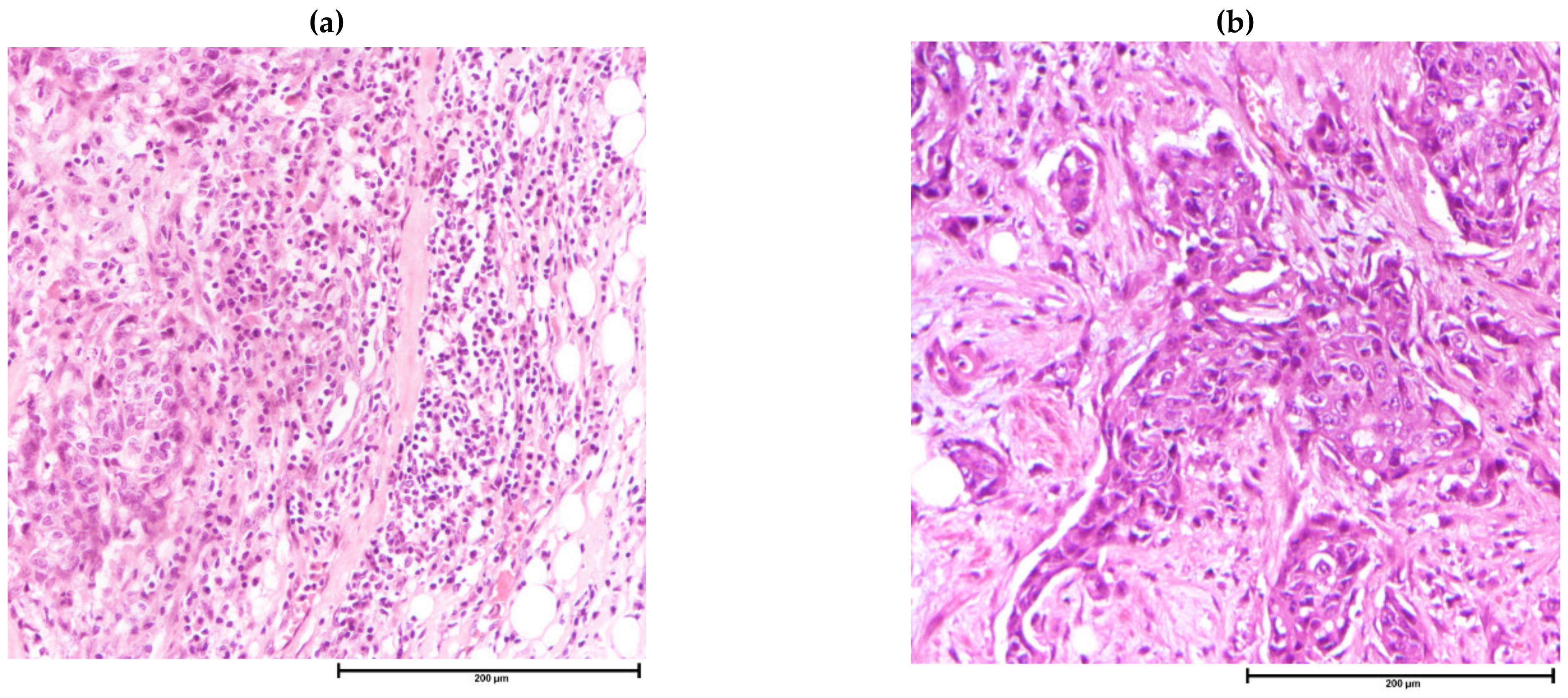 Cancers 13 04233 g002