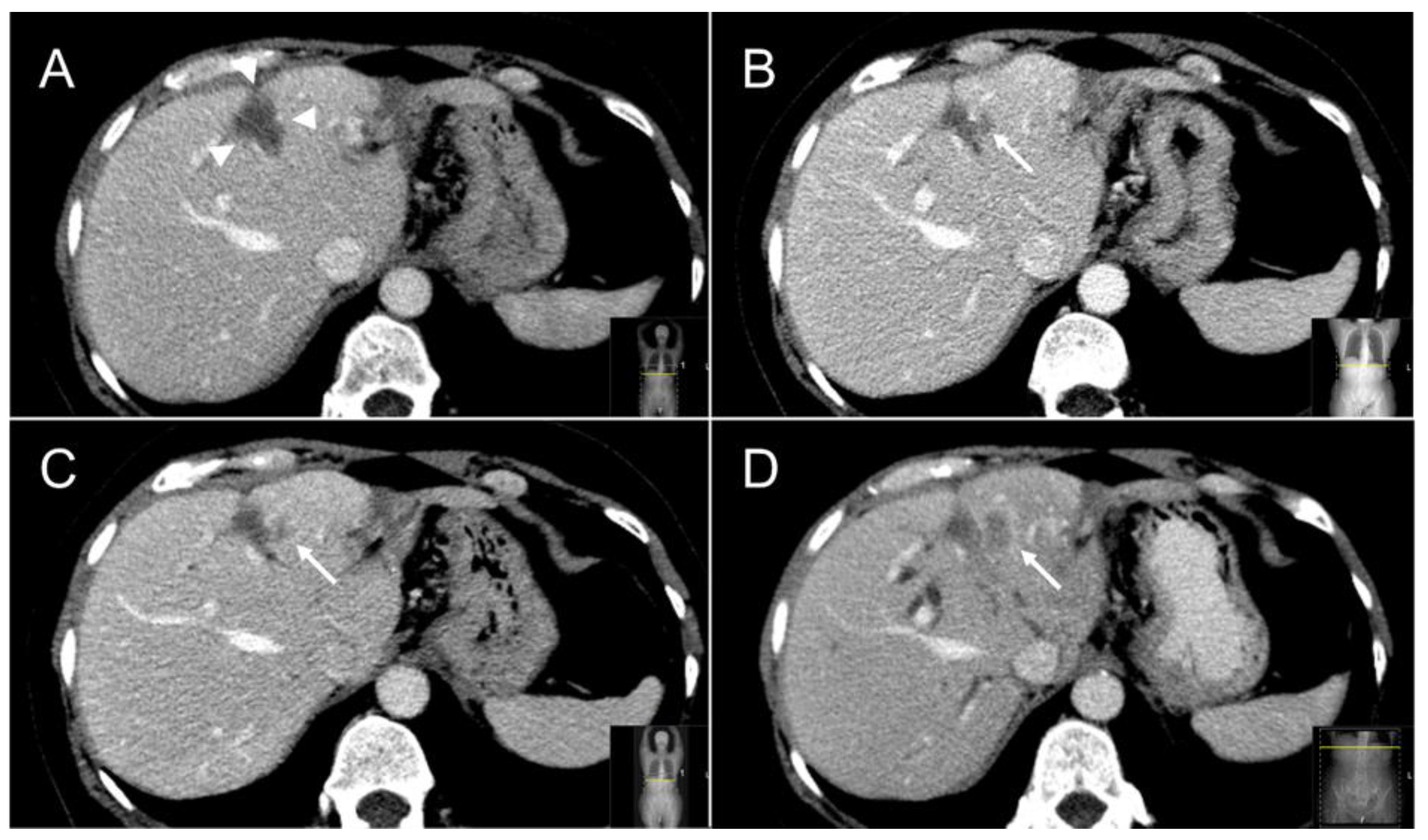 Cancers 13 04303 g006