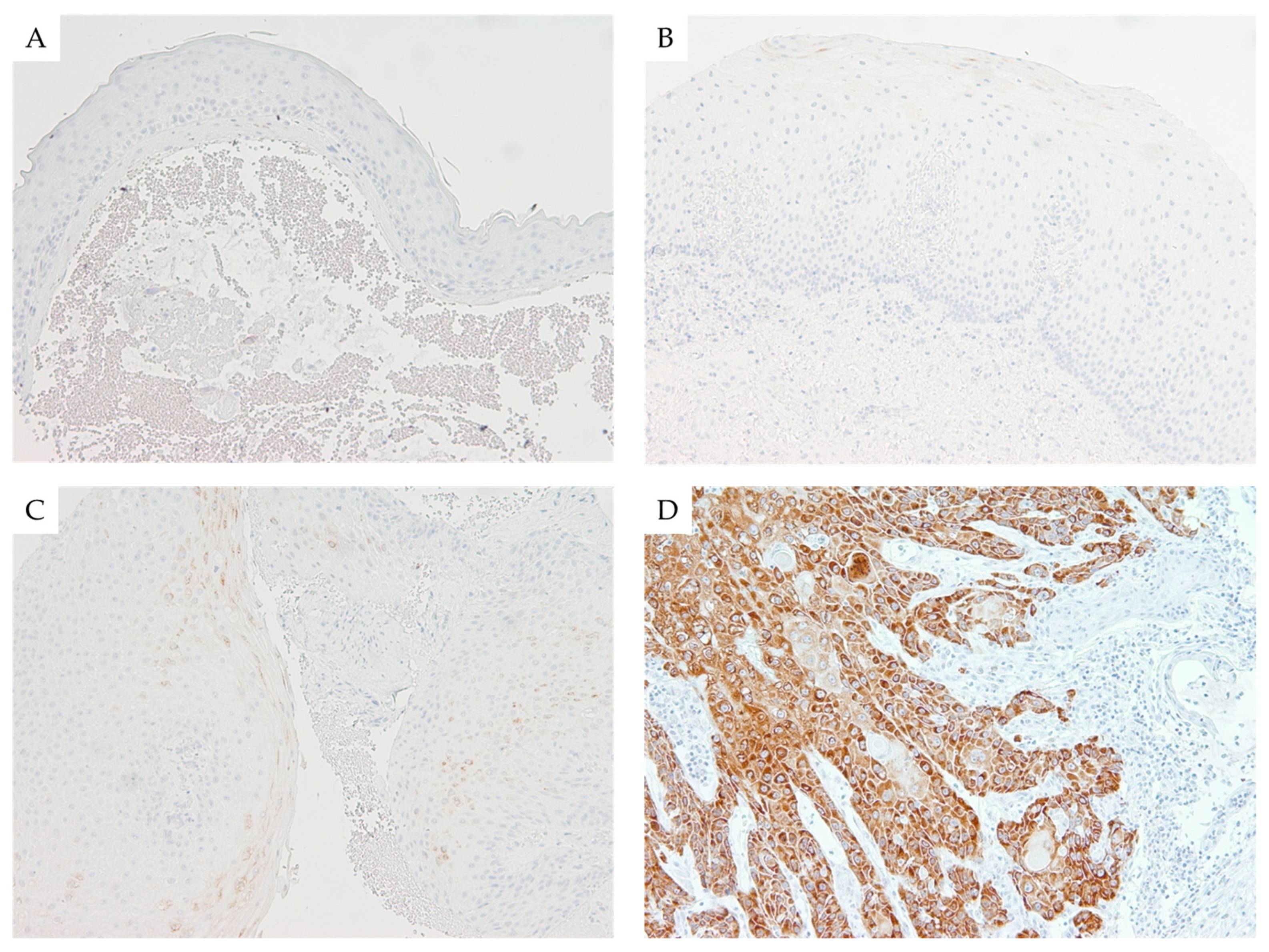 Cancers 13 04306 g002