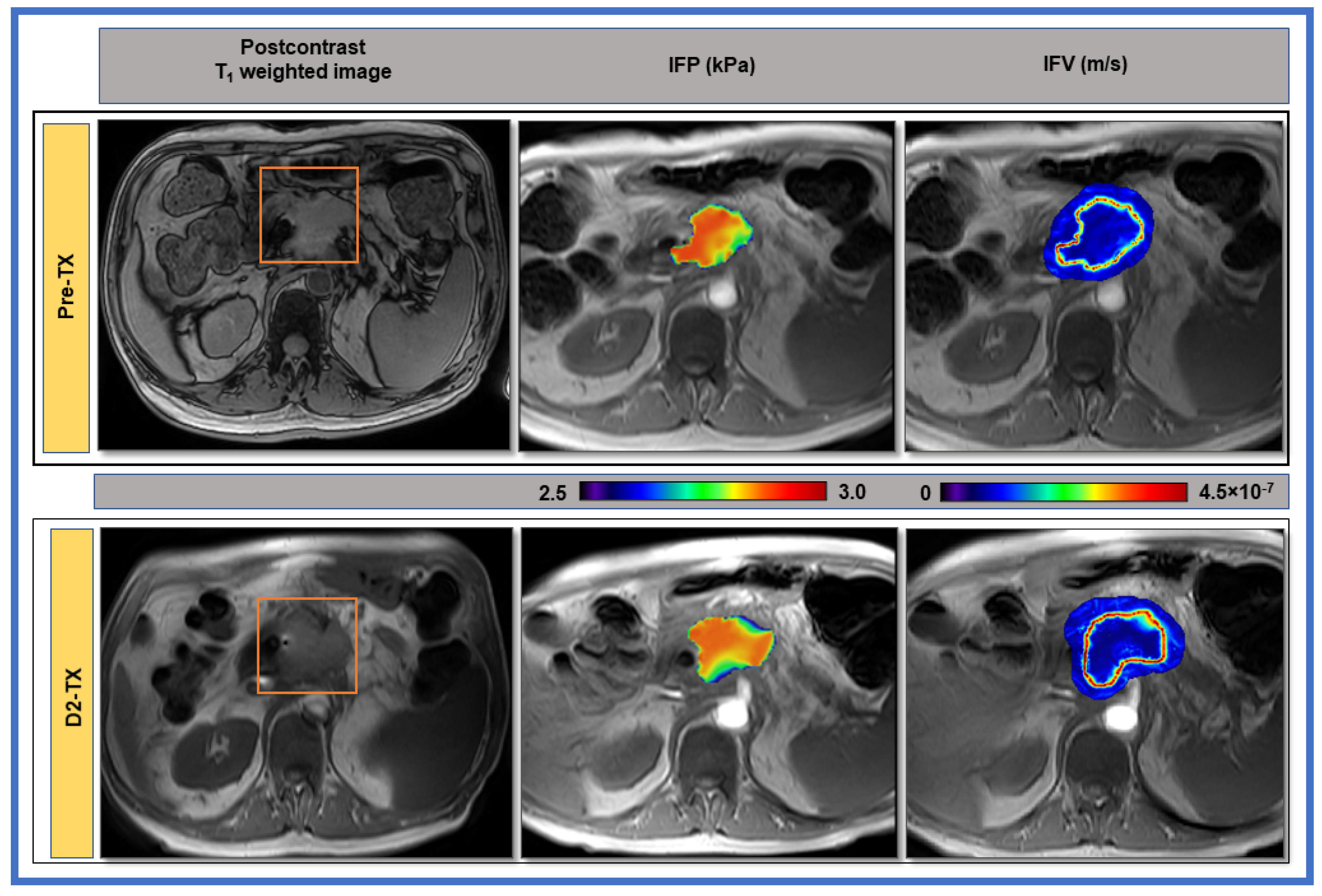 Cancers 13 04319 g005 Cancers 13 04319 g005