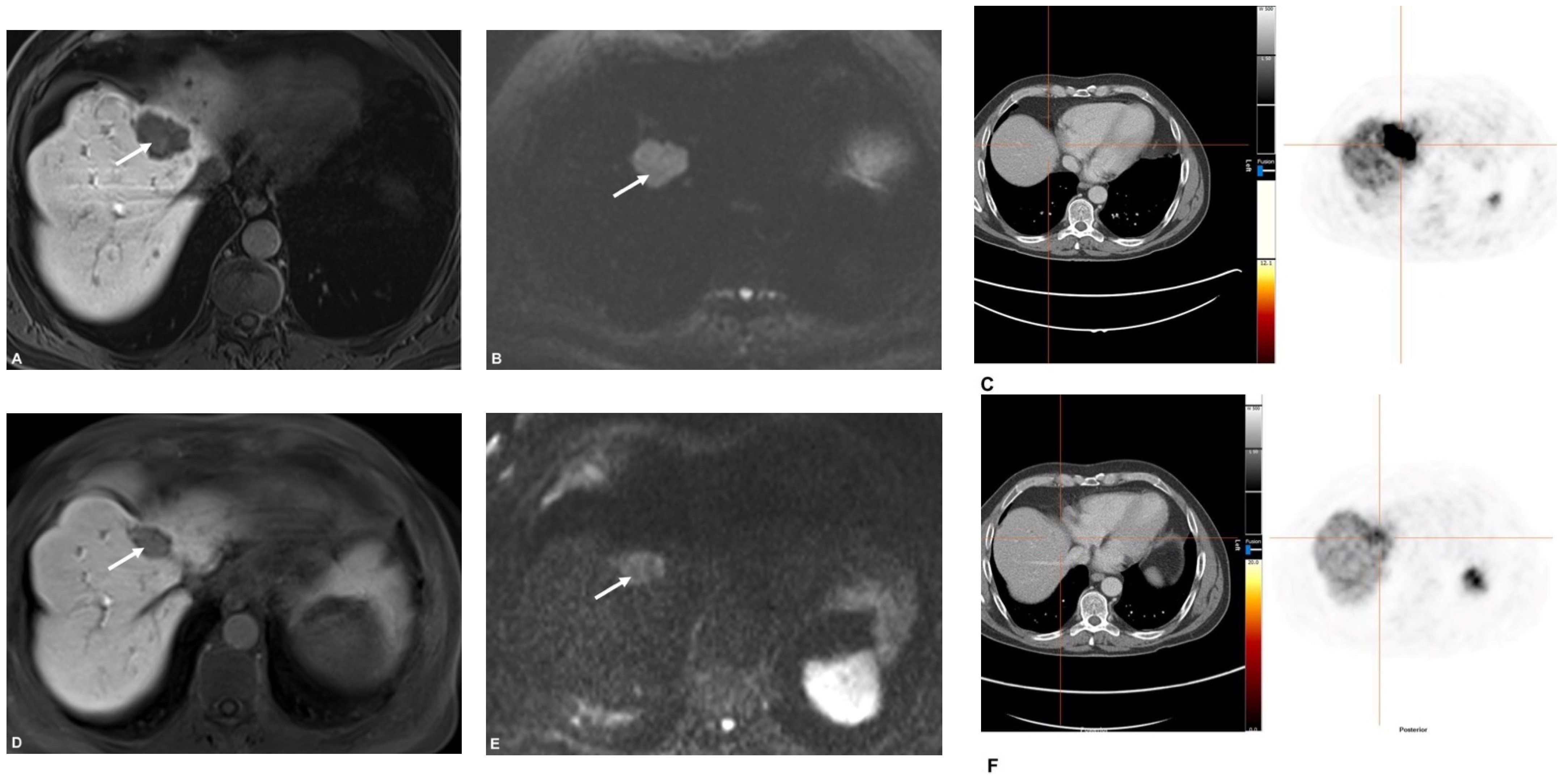 Cancers 13 04321 g004