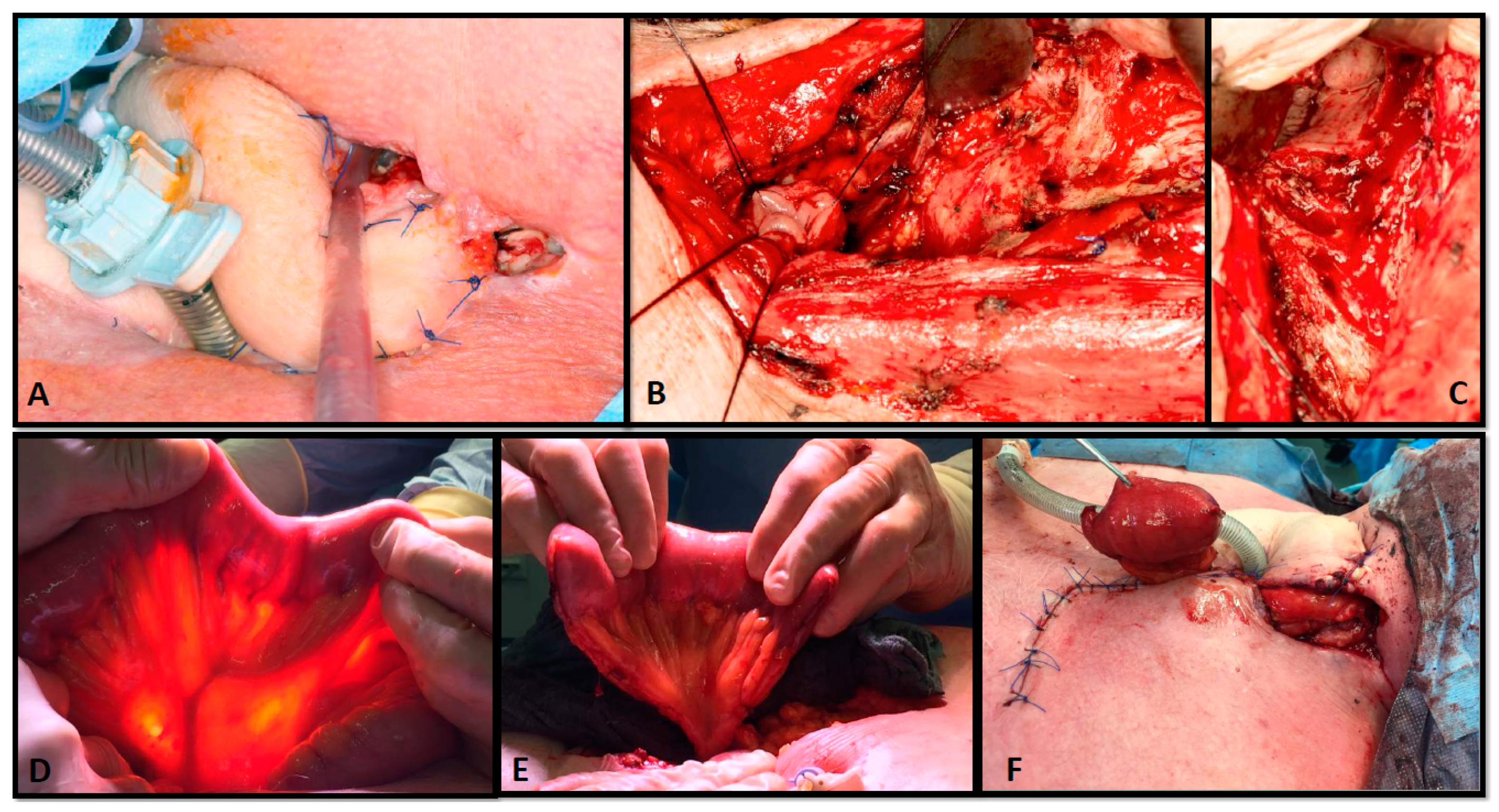 Cancers 13 04329 g002