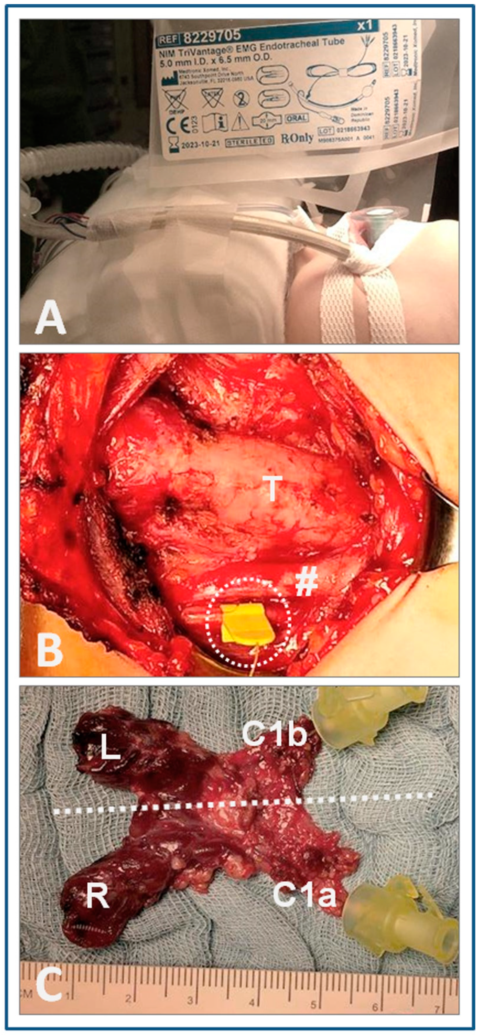 Cancers 13 04333 g004