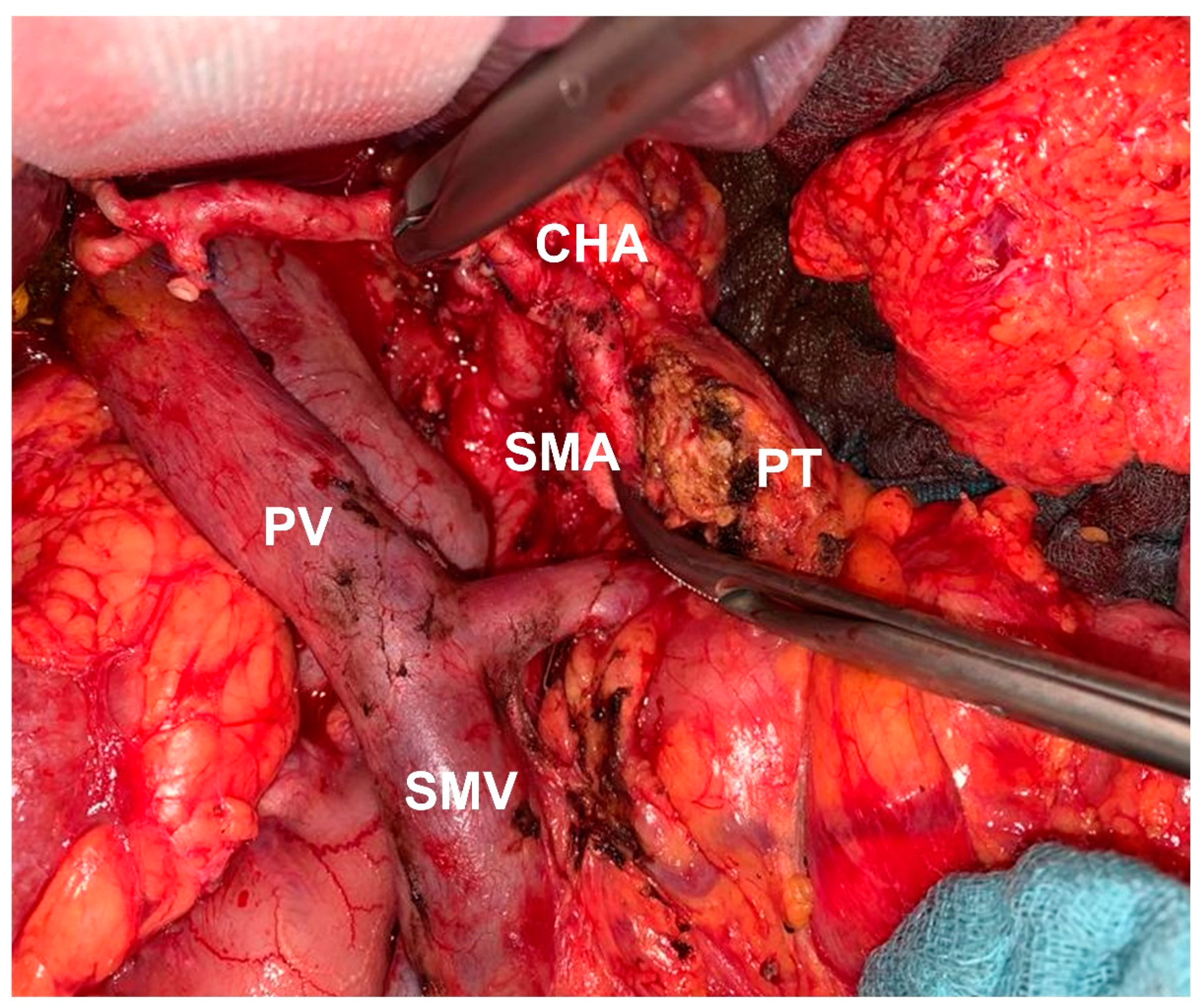 Cancers 13 04361 g003