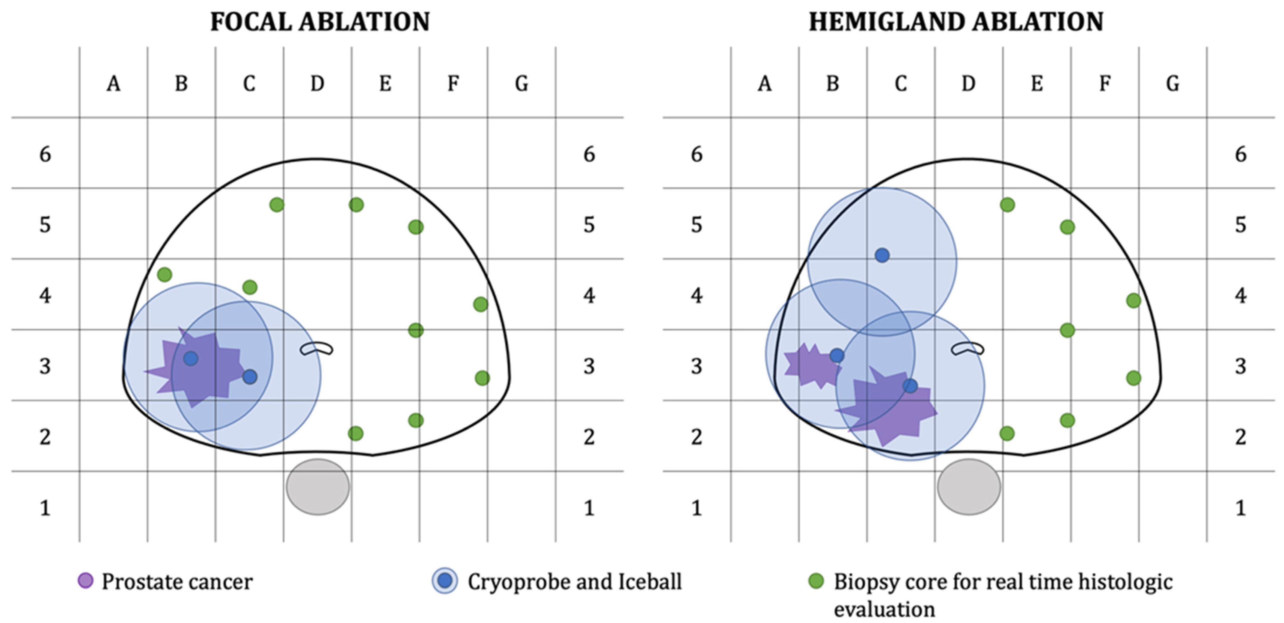 Cancers 13 04382 g001