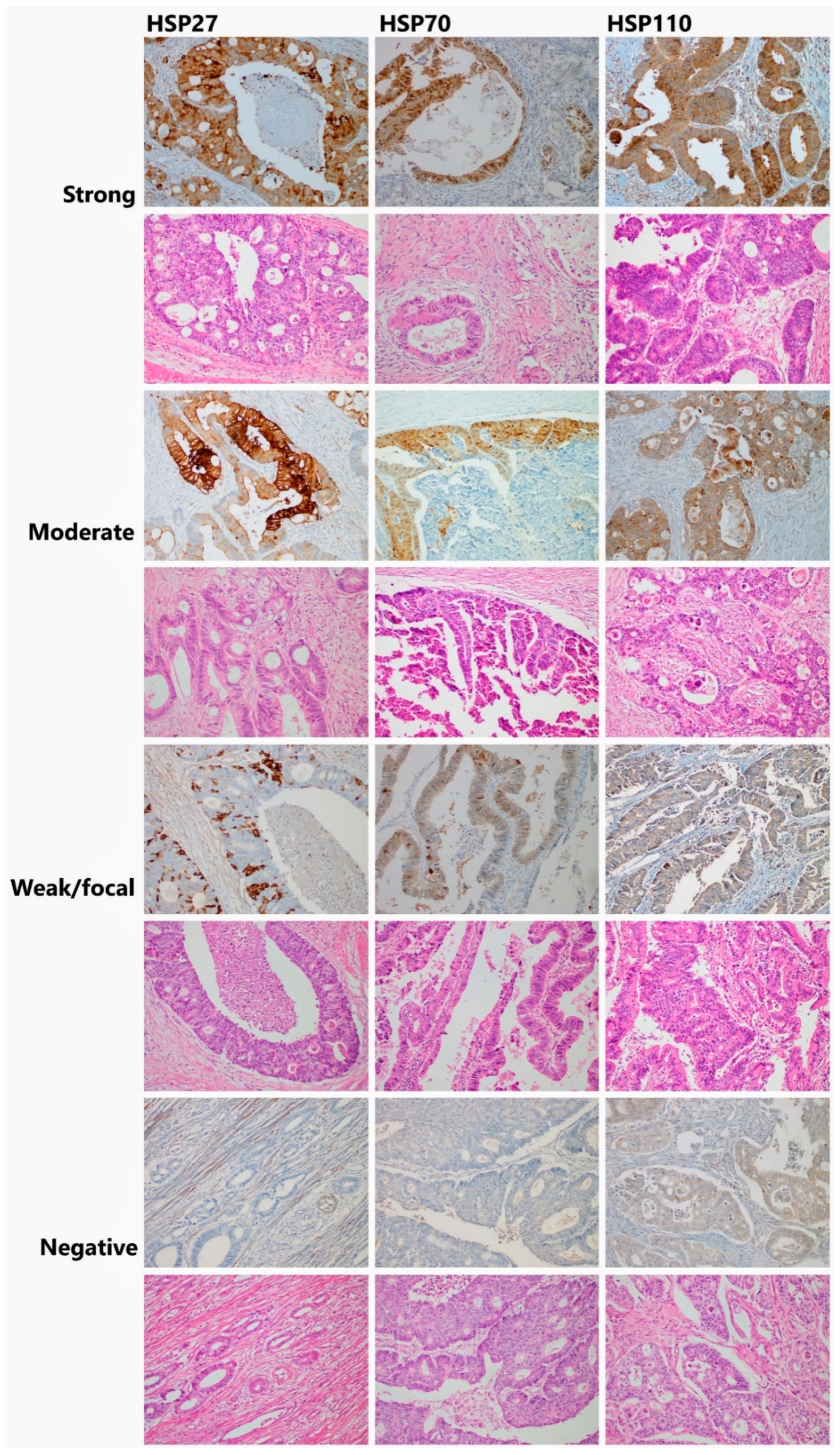 Cancers 13 04407 g001