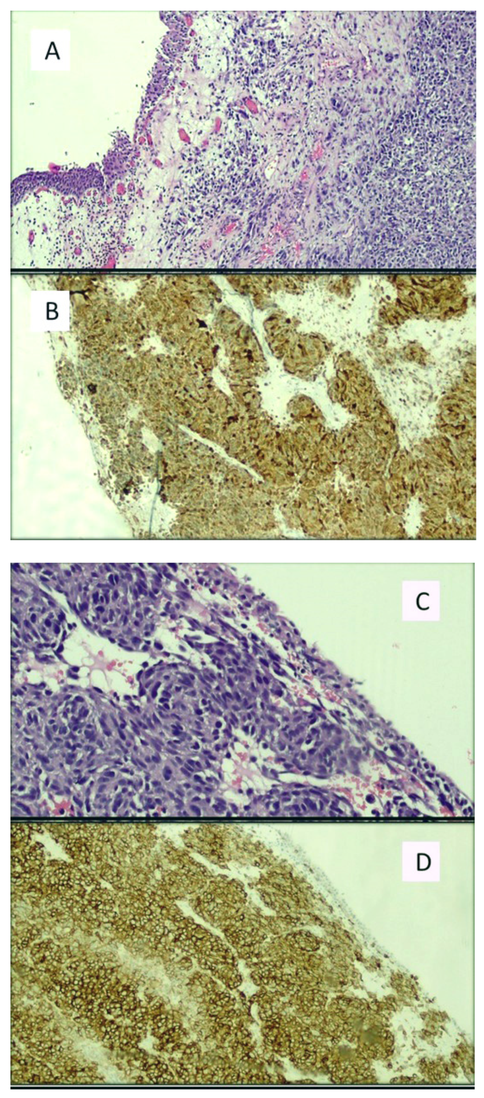 Cancers 13 04424 g002 Cancers 13 04424 g002