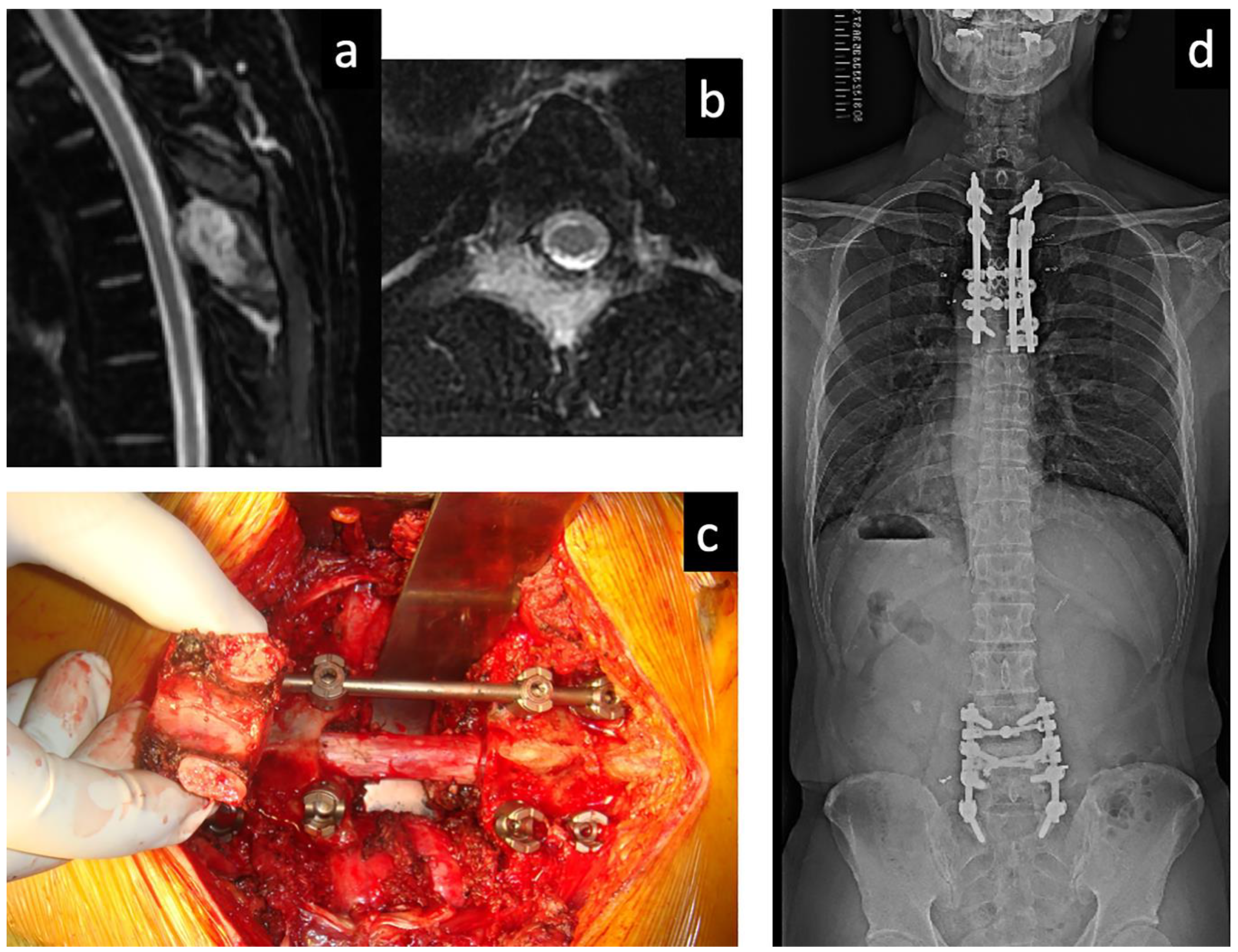 Cancers 13 04429 g001