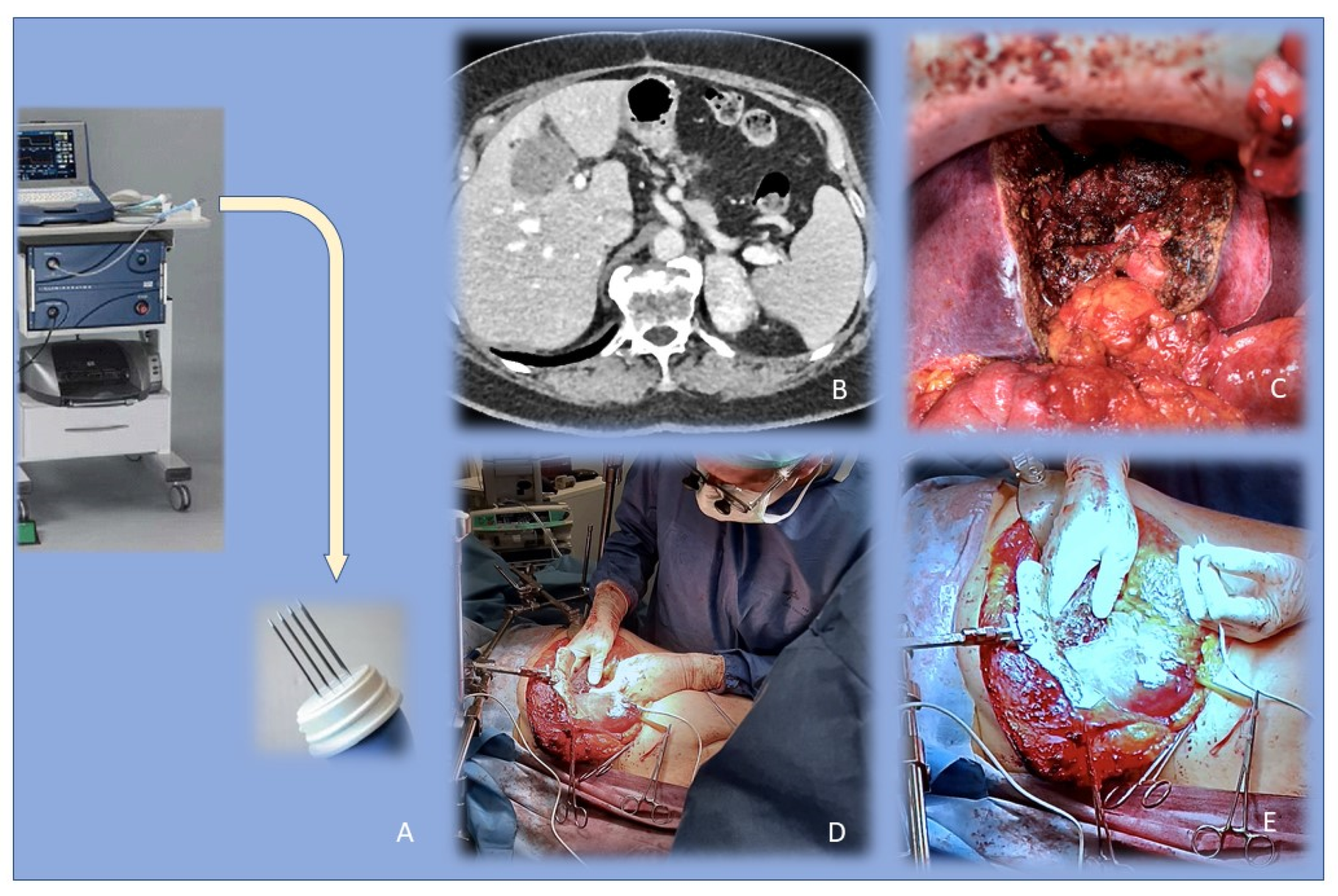 Cancers 13 04437 g001