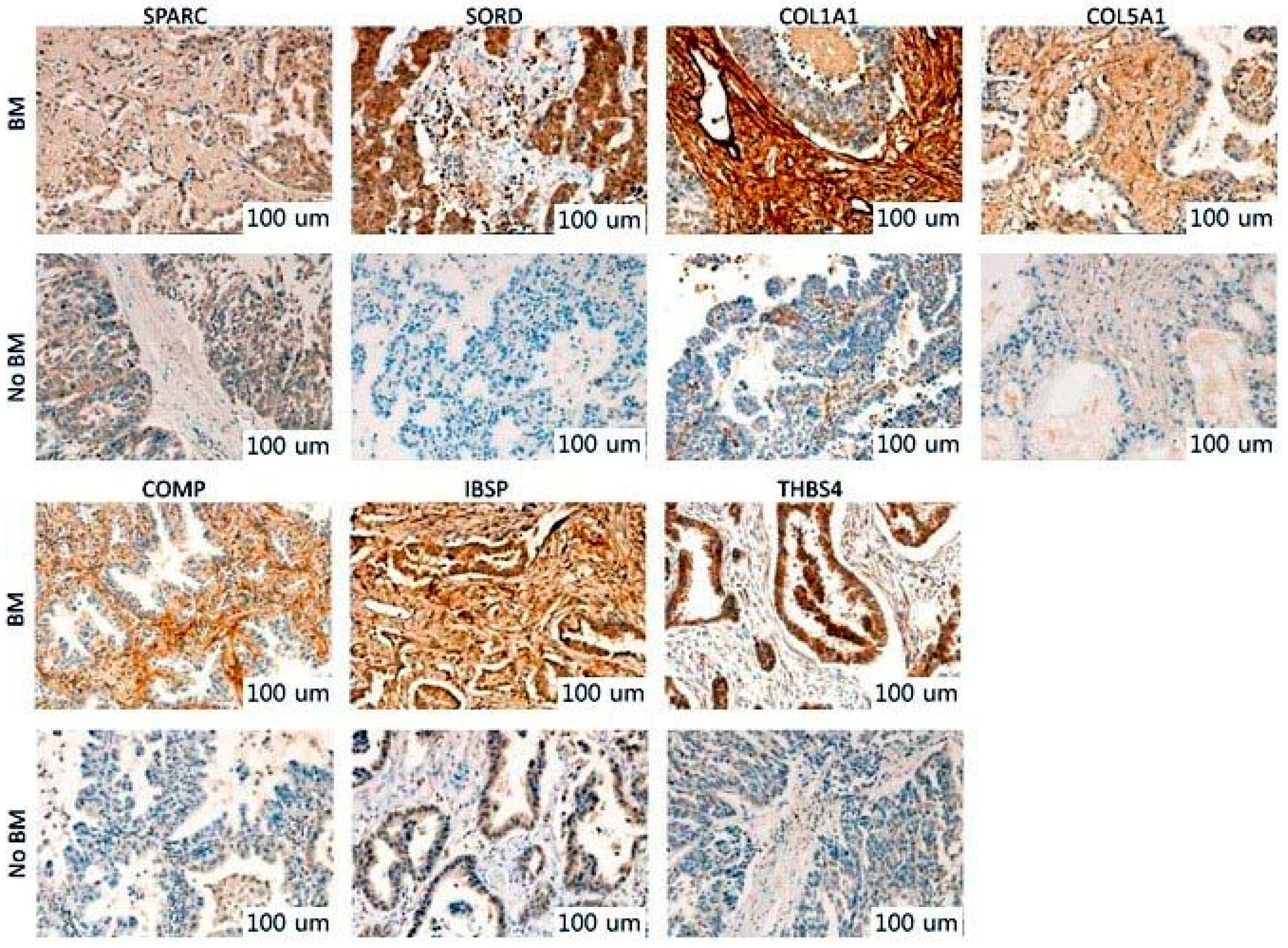 Cancers 13 04468 g006