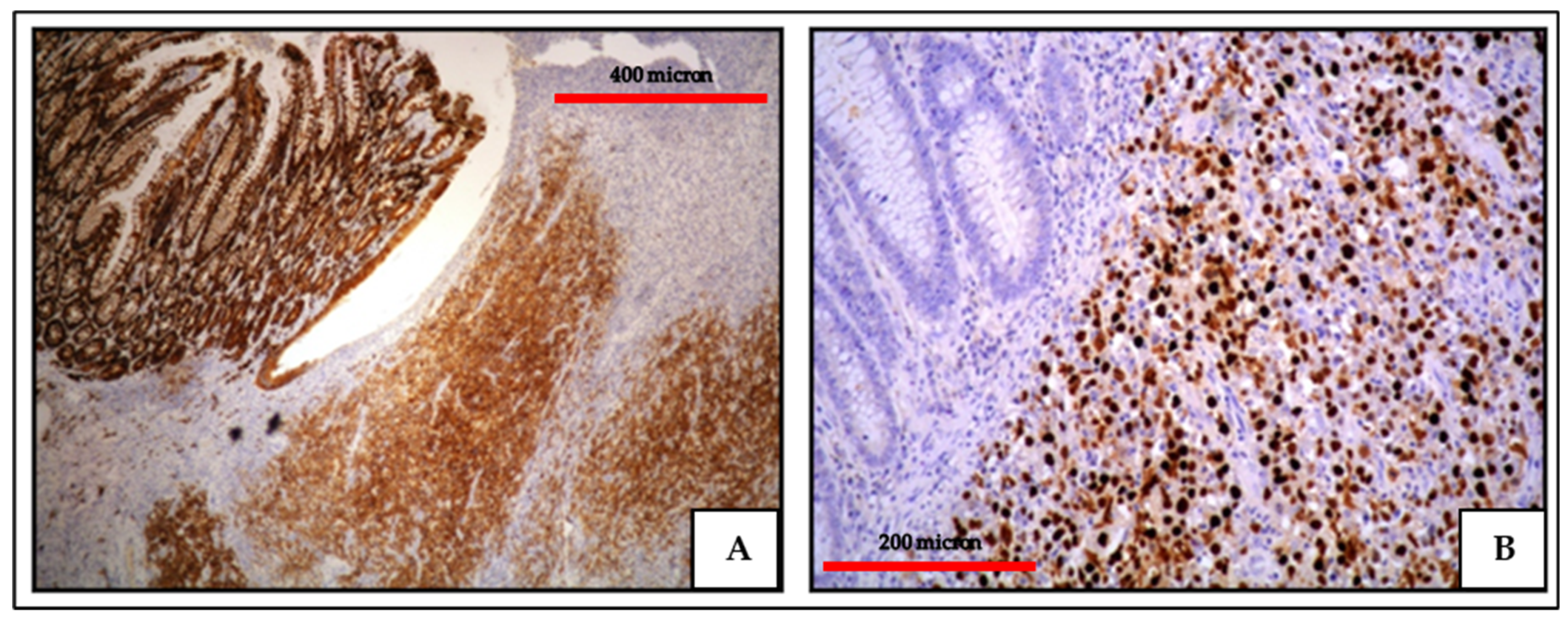 Cancers 13 04527 g002