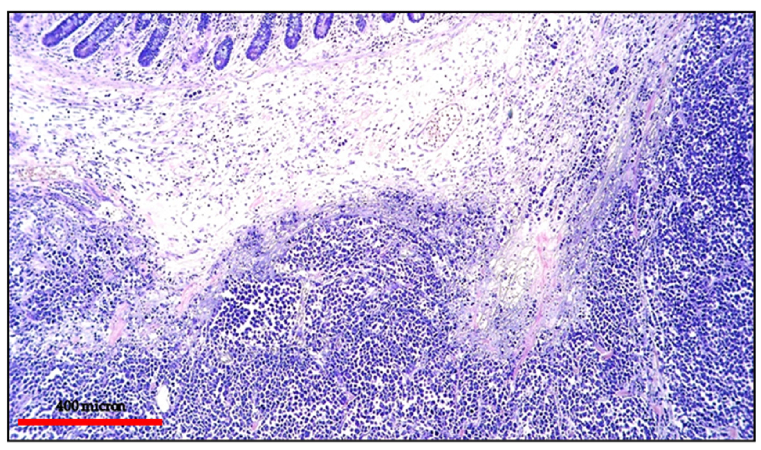 Cancers 13 04527 g004