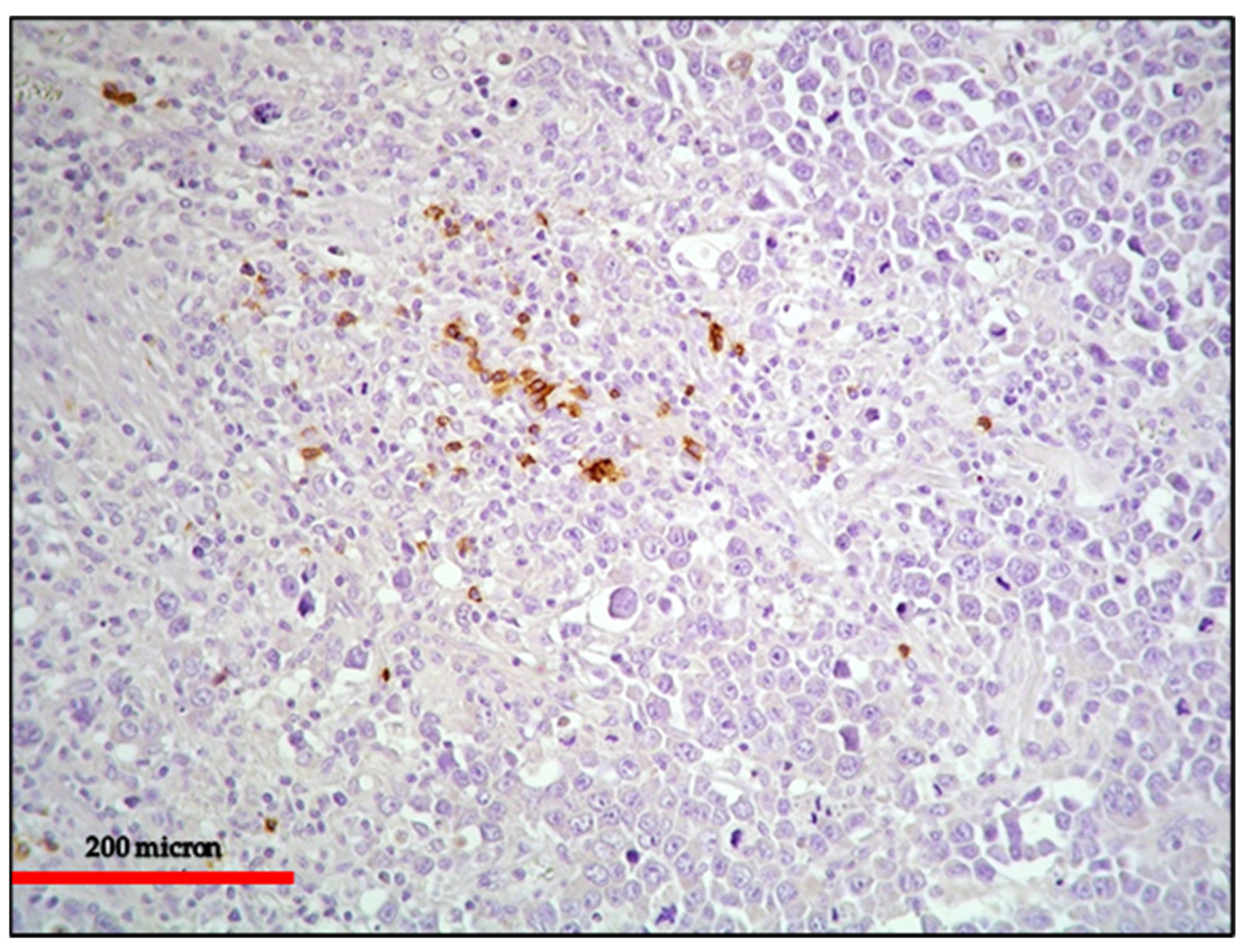 Cancers 13 04527 g006