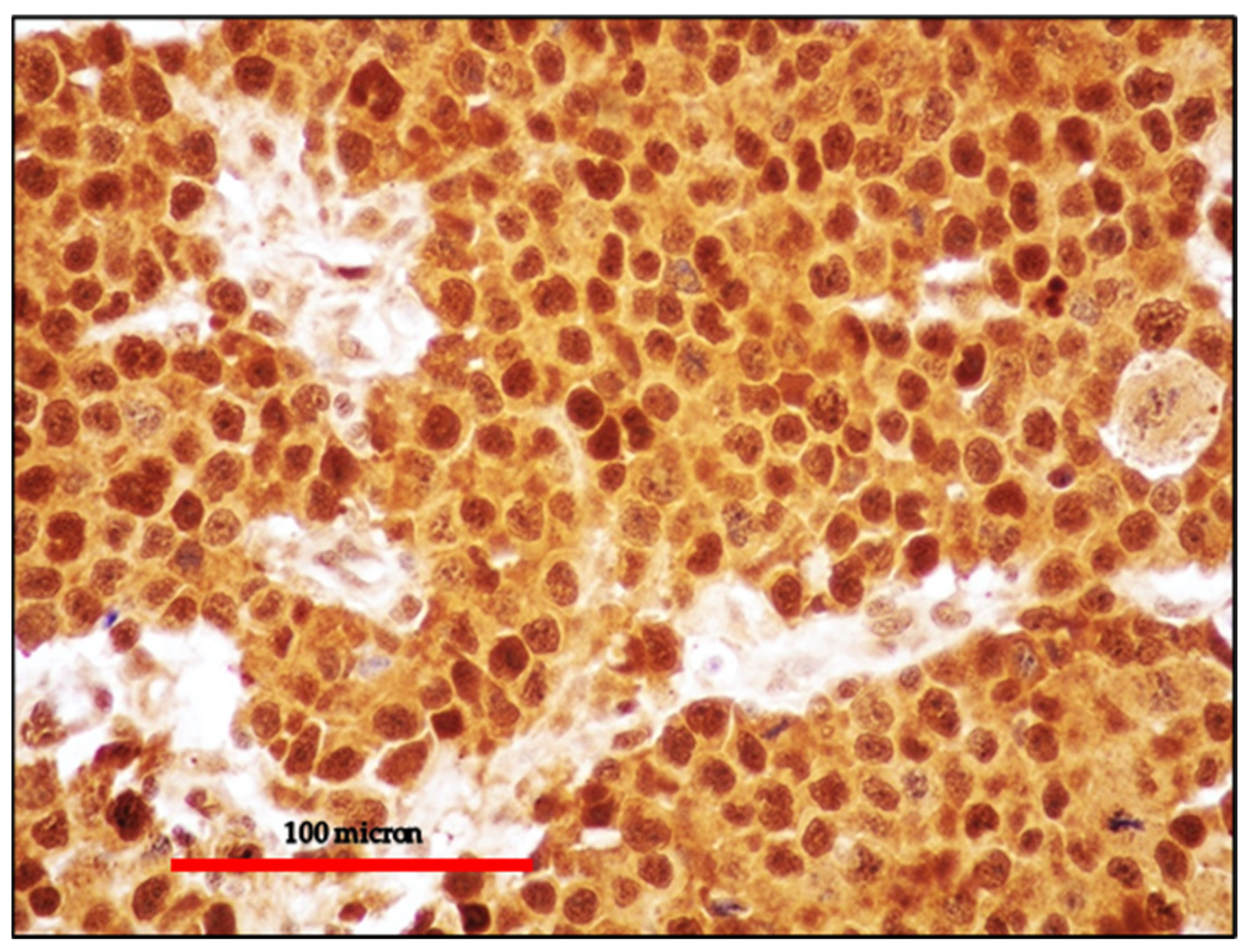 Cancers 13 04527 g007