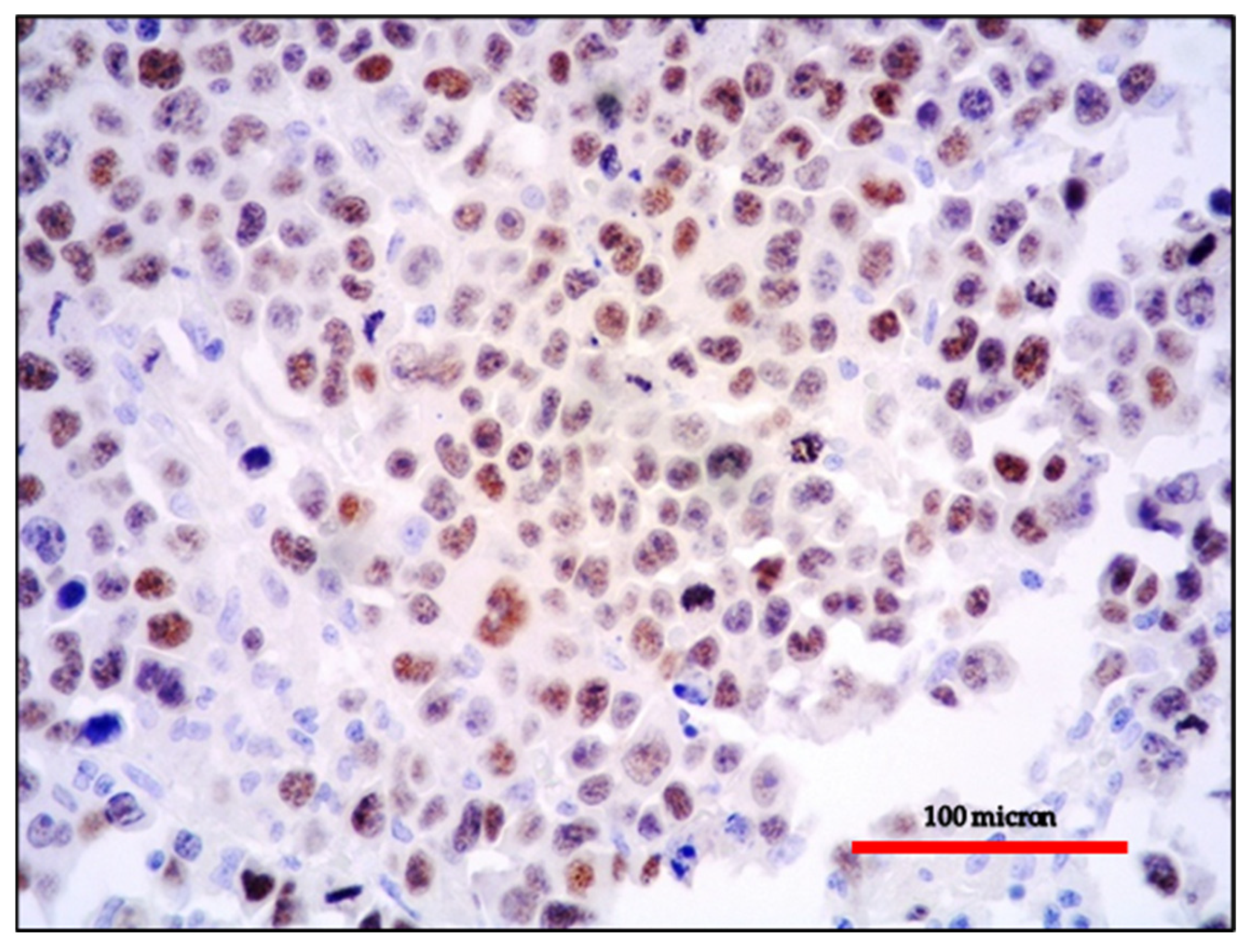 Cancers 13 04527 g009