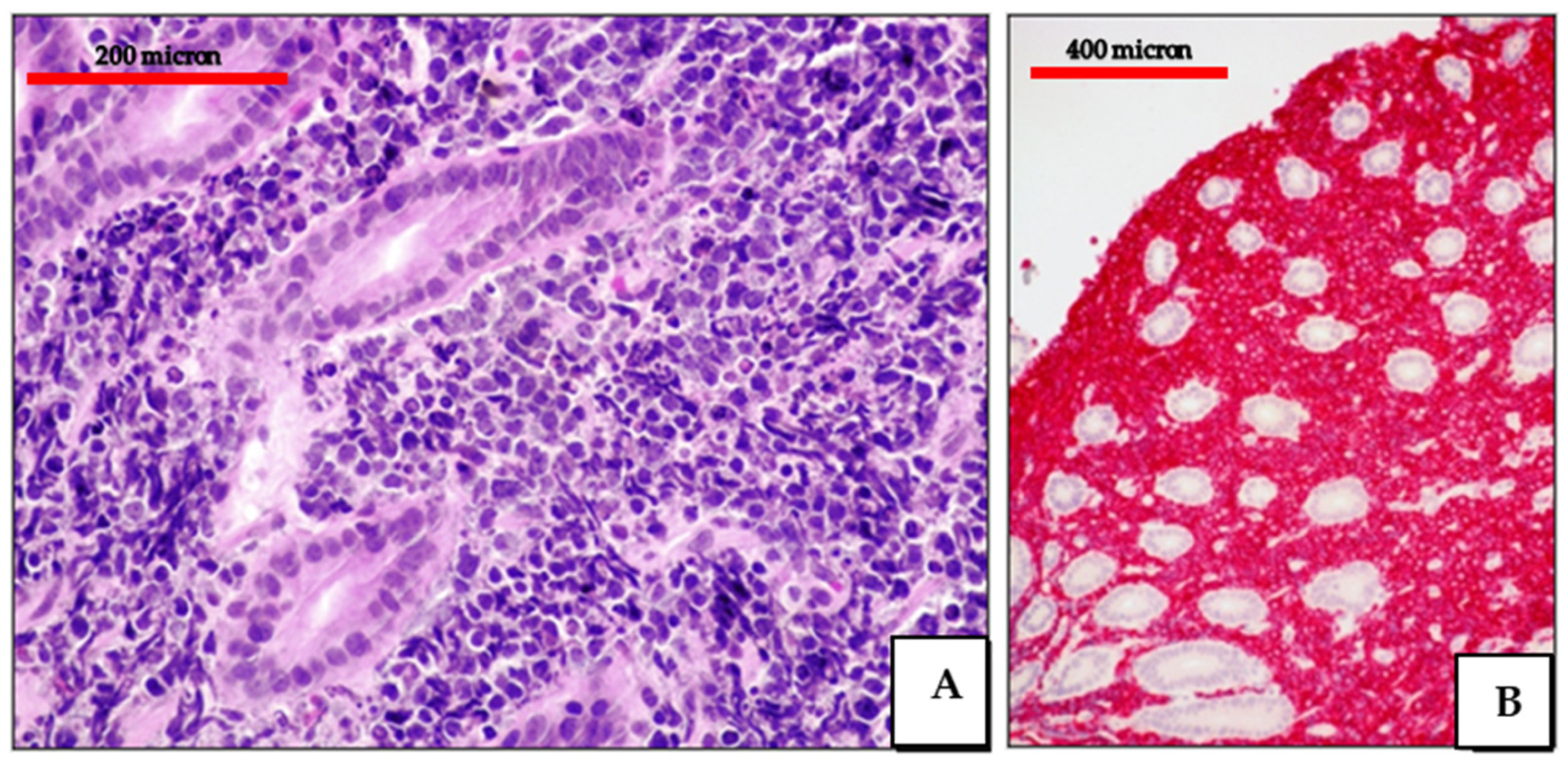 Cancers 13 04527 g010