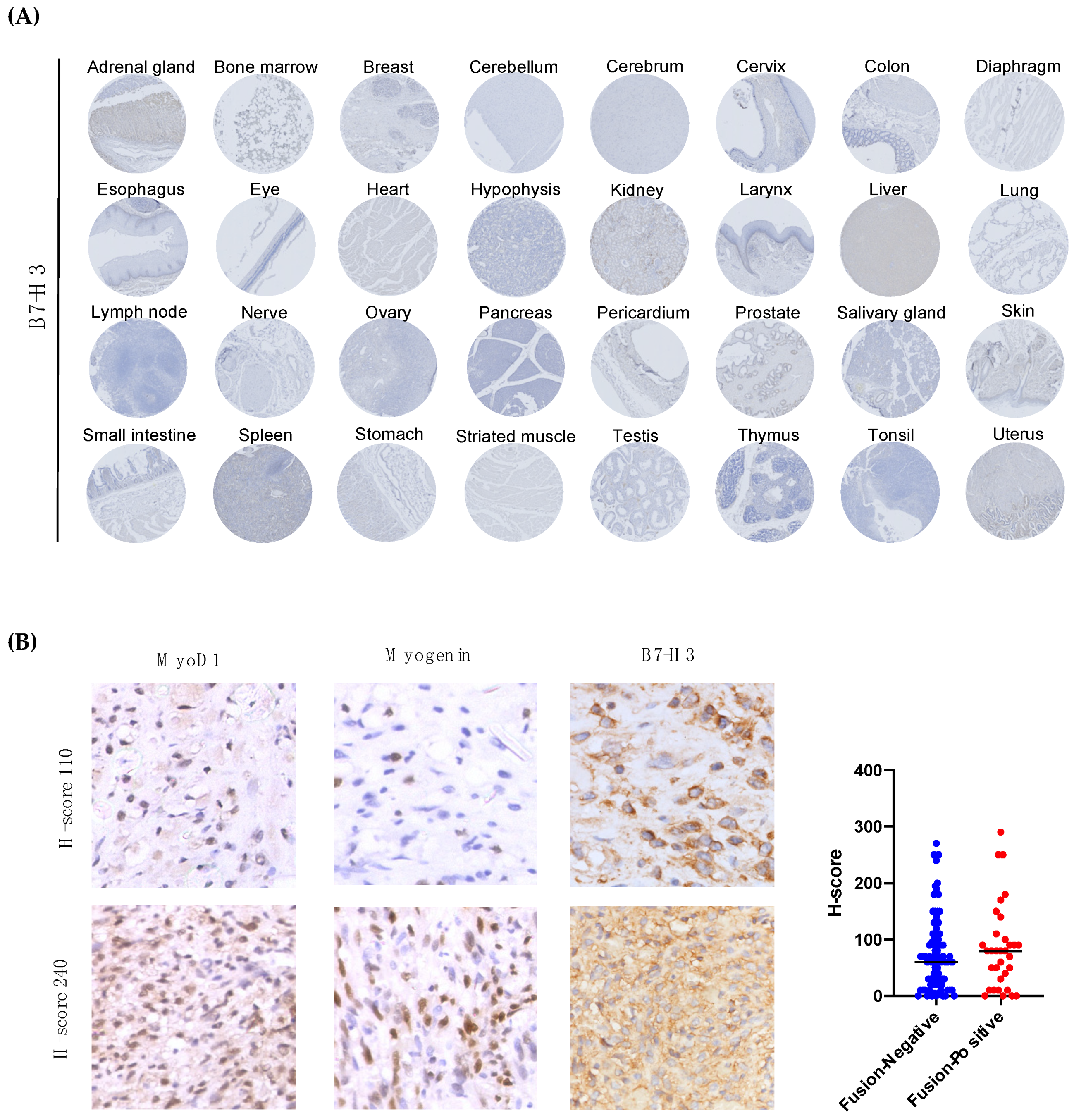 Cancers 13 04528 g004
