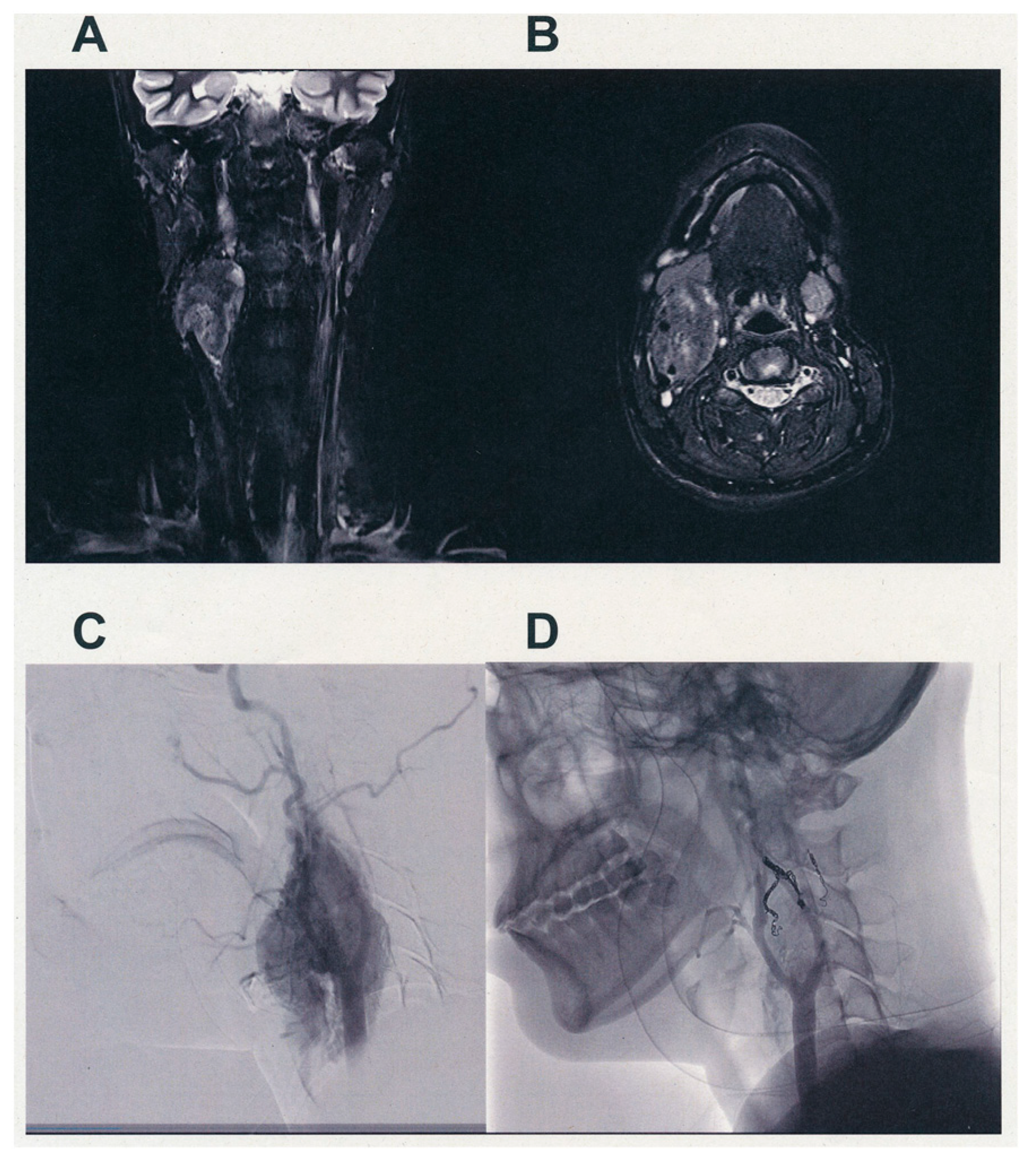 Cancers 13 04565 g001