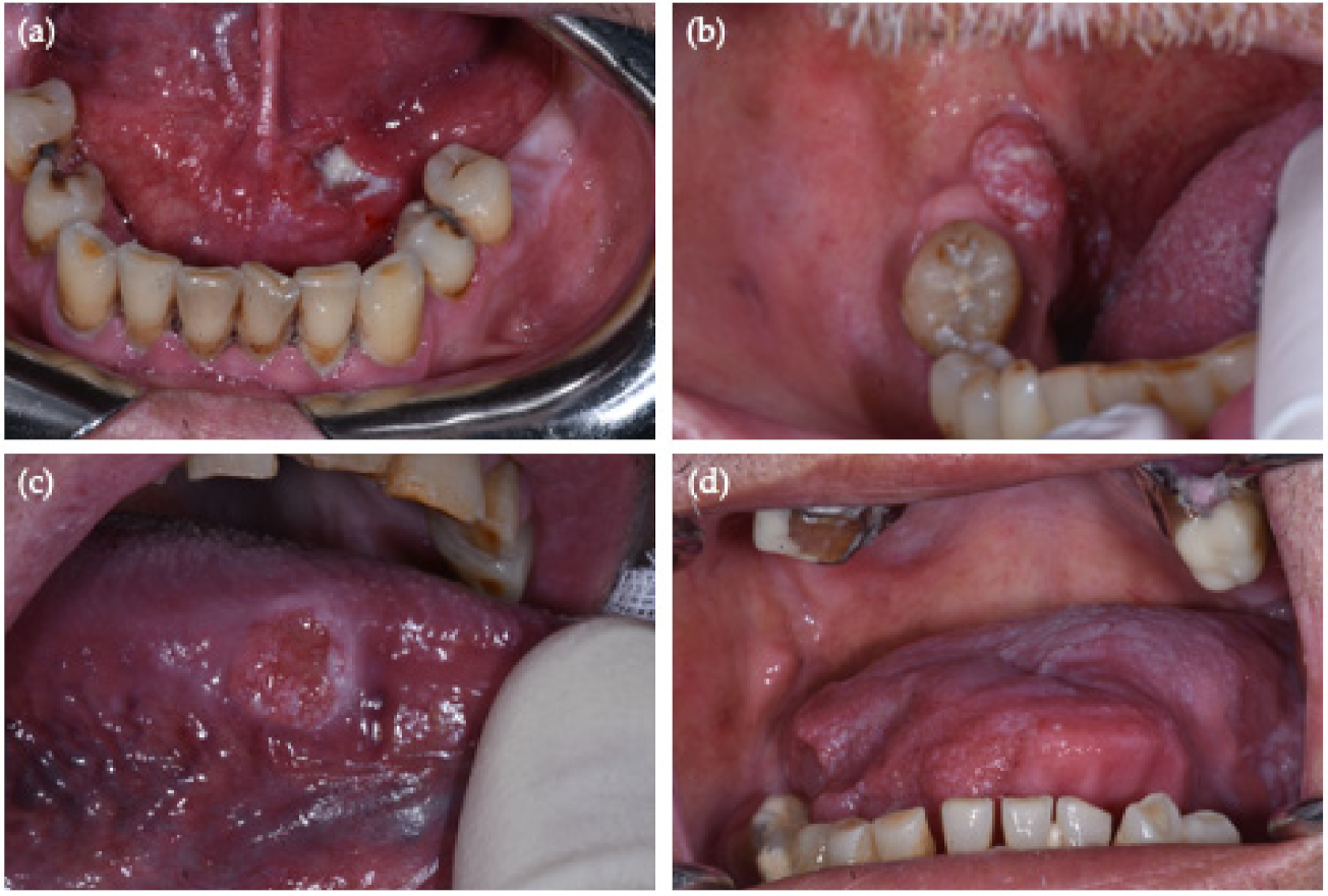 Cancers 13 04595 g001