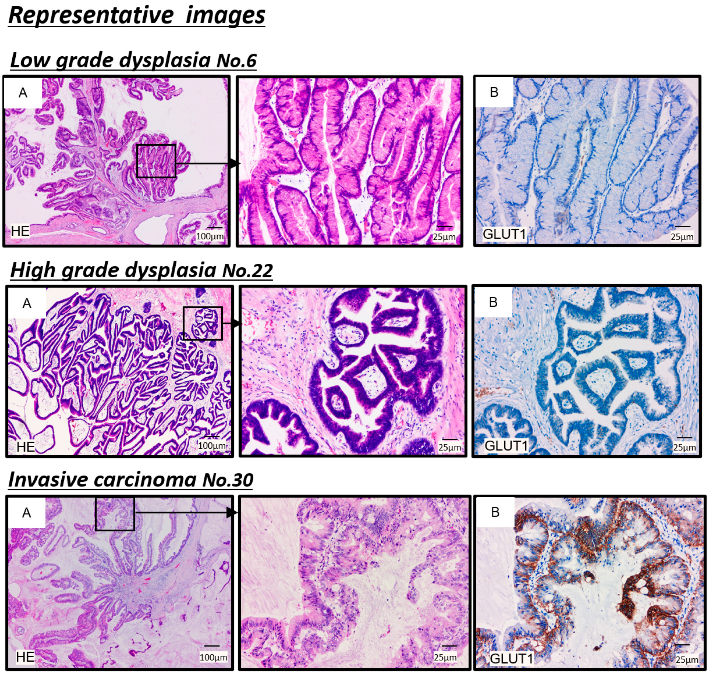 Cancers 13 04633 g004