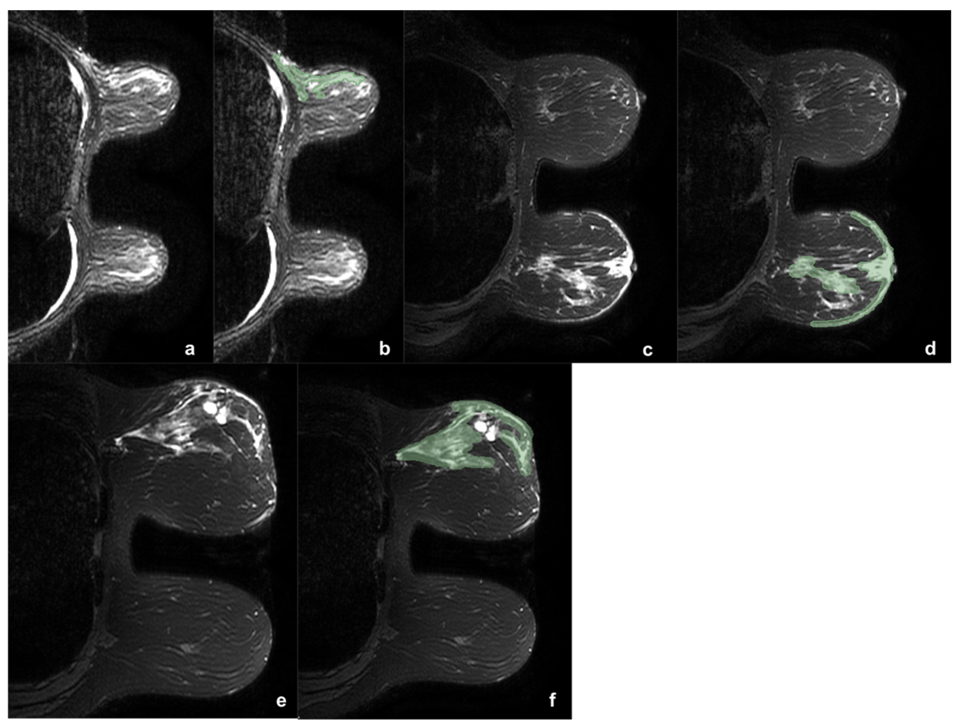 Cancers 13 04635 g001