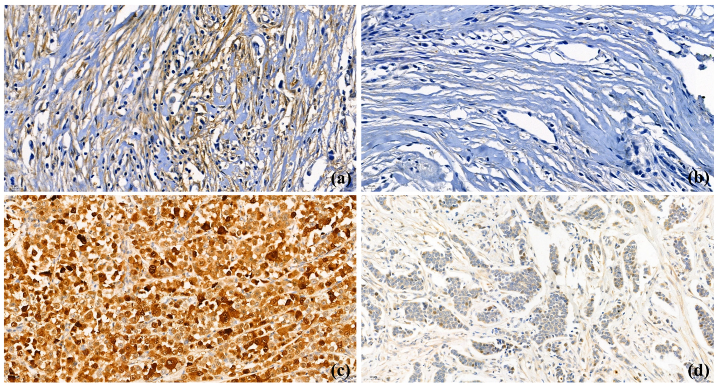 Cancers 13 04654 g001