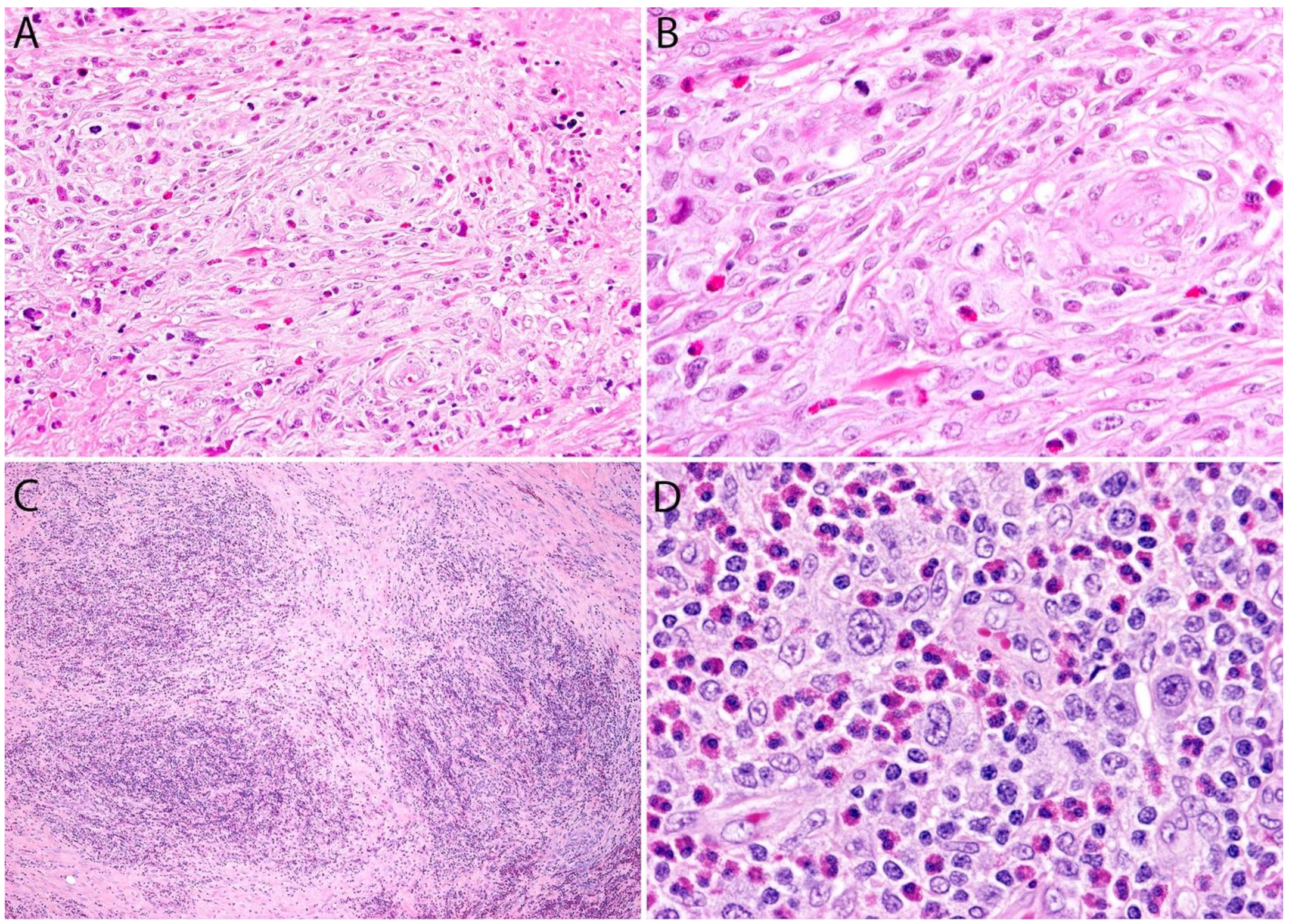 Cancers 13 04667 g003 Cancers 13 04667 g003