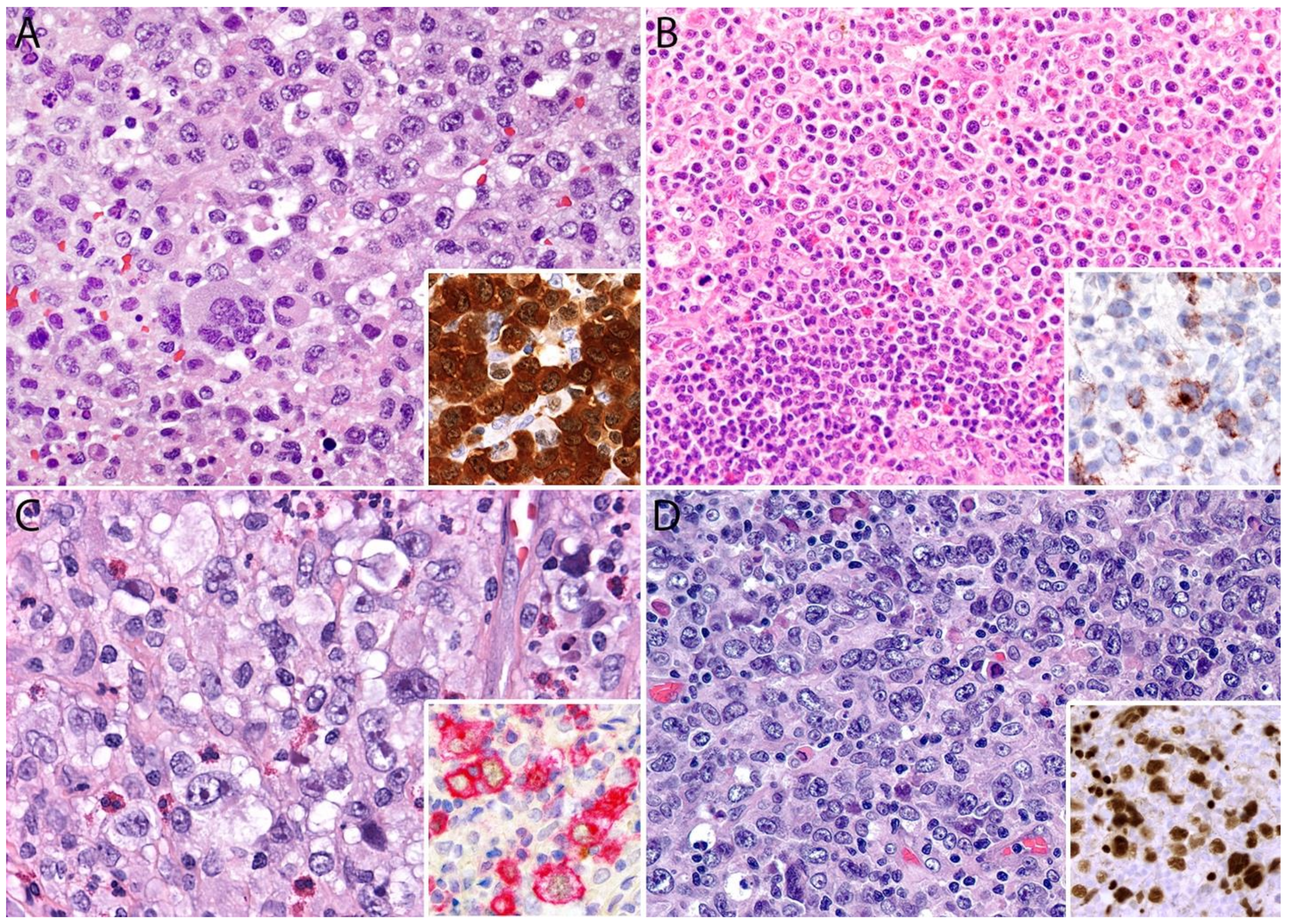 Cancers 13 04667 g006 Cancers 13 04667 g006