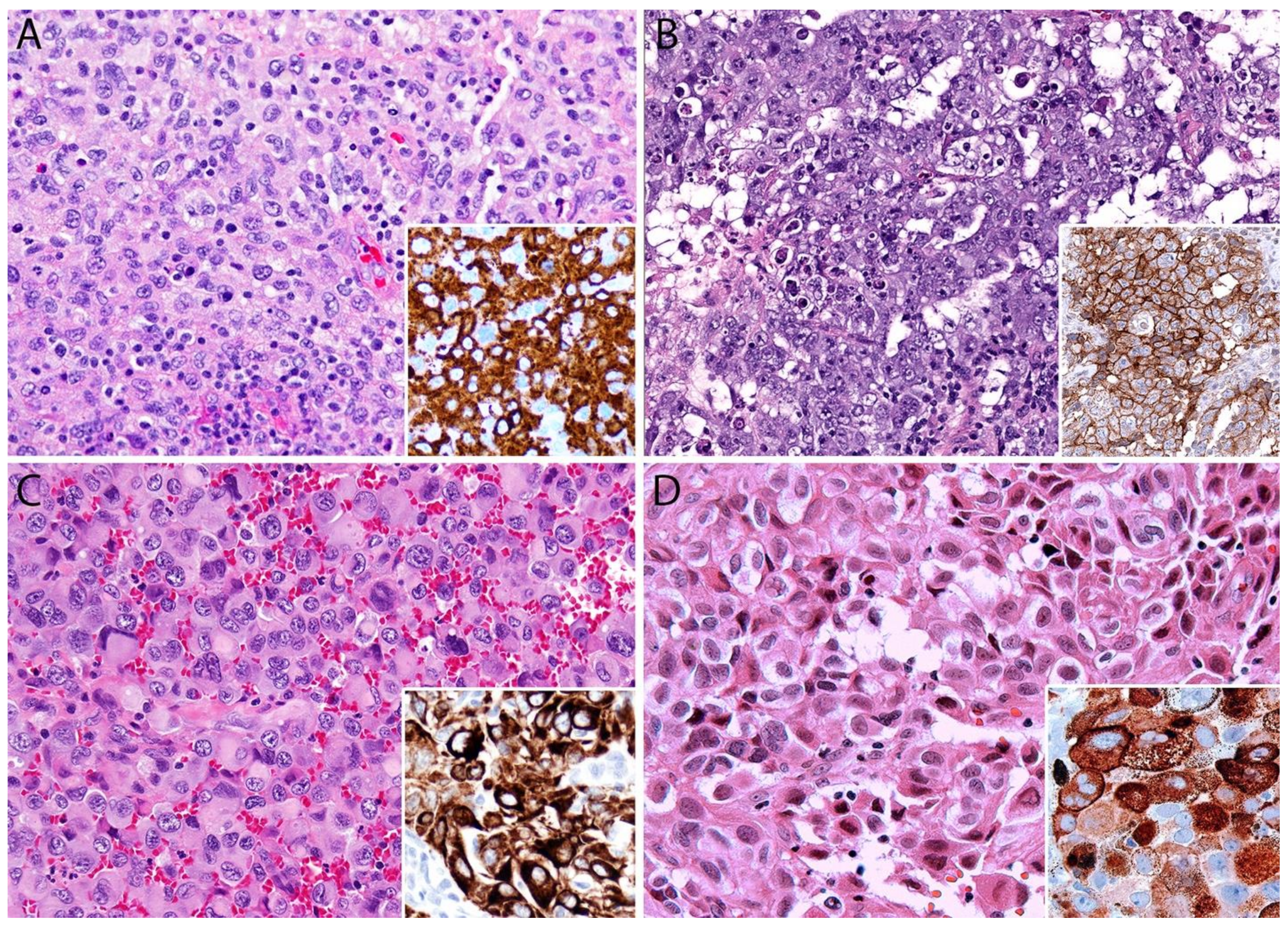 Cancers 13 04667 g007 Cancers 13 04667 g007