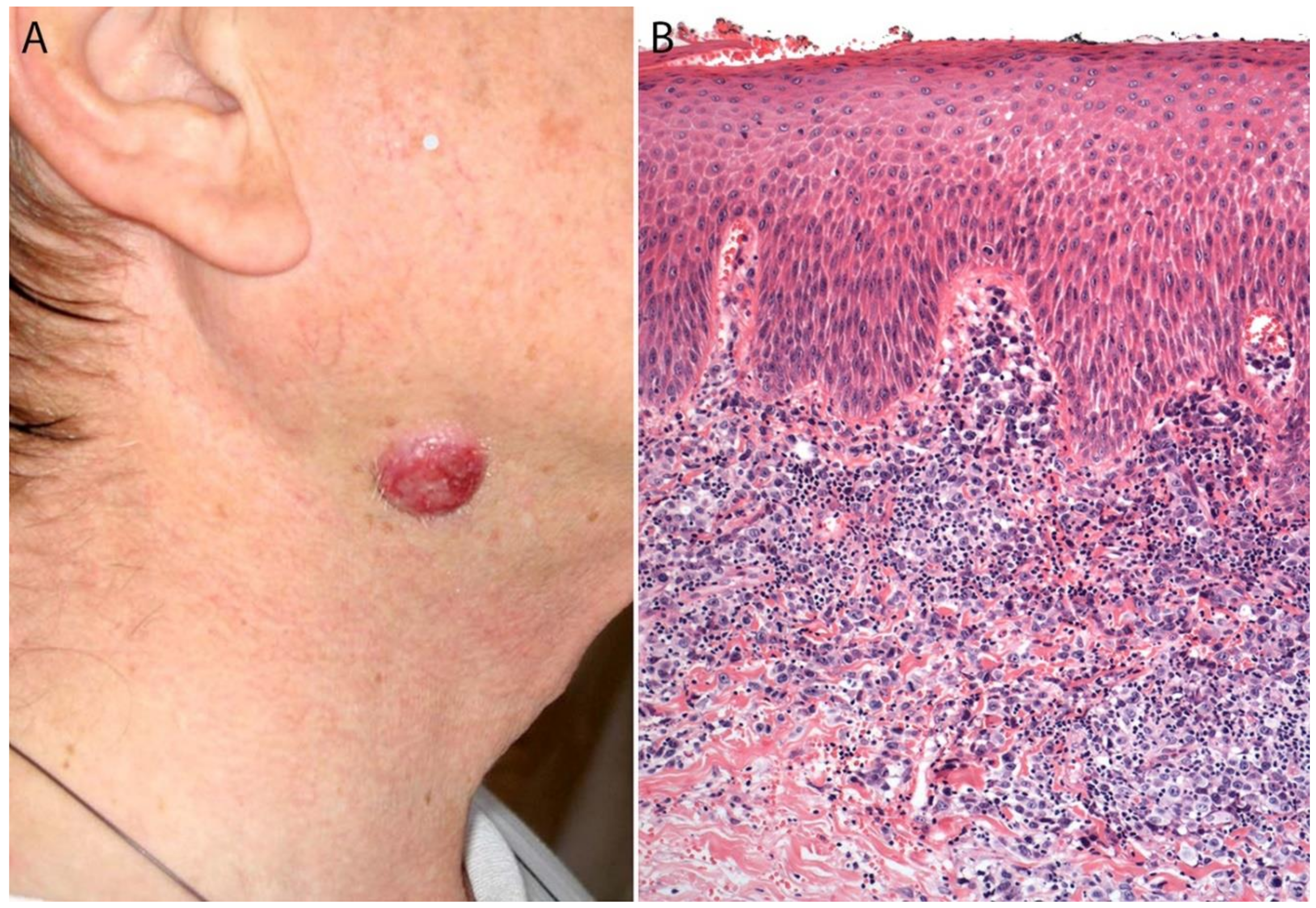 Cancers 13 04667 g011 Cancers 13 04667 g011