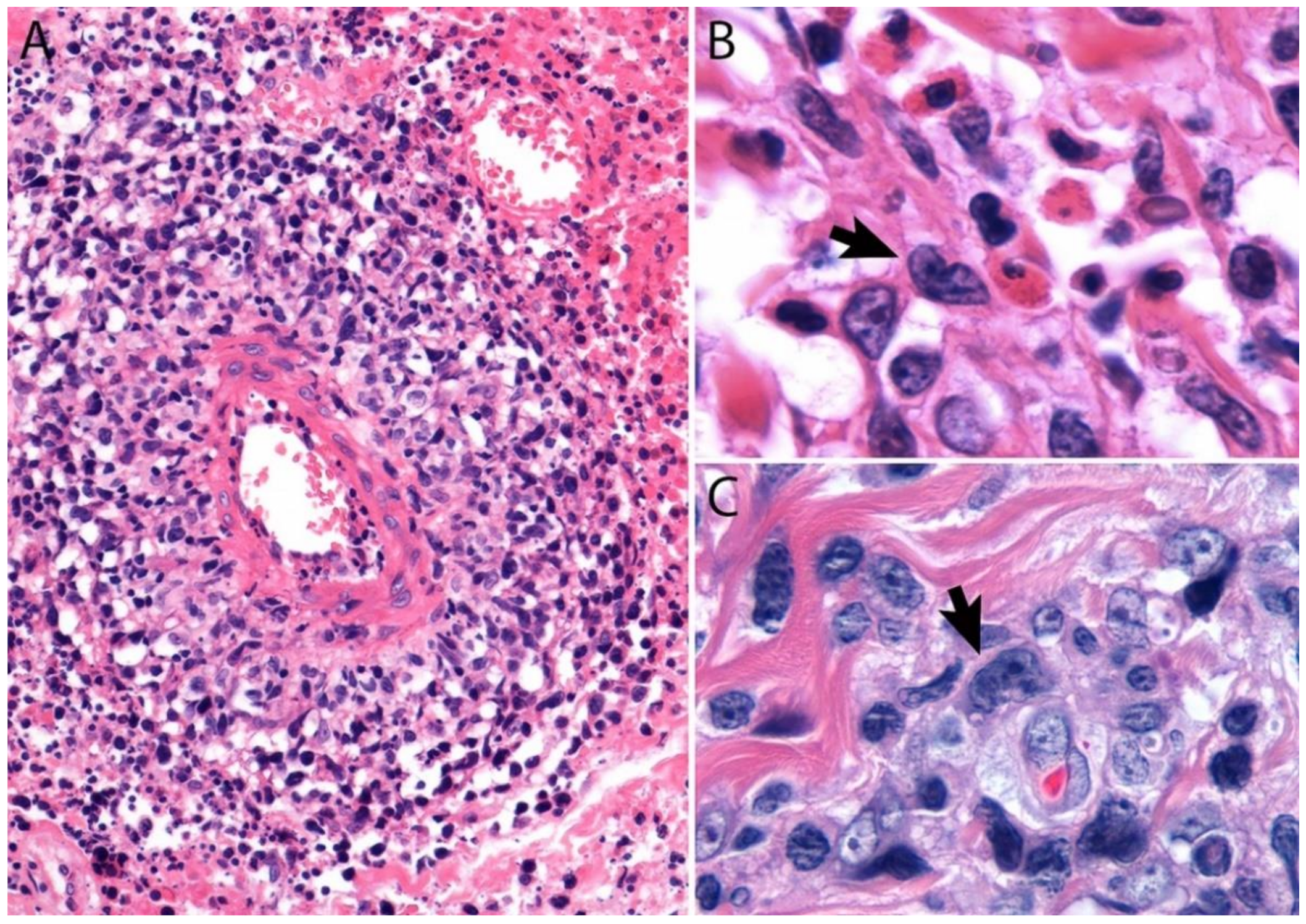 Cancers 13 04667 g013 Cancers 13 04667 g013