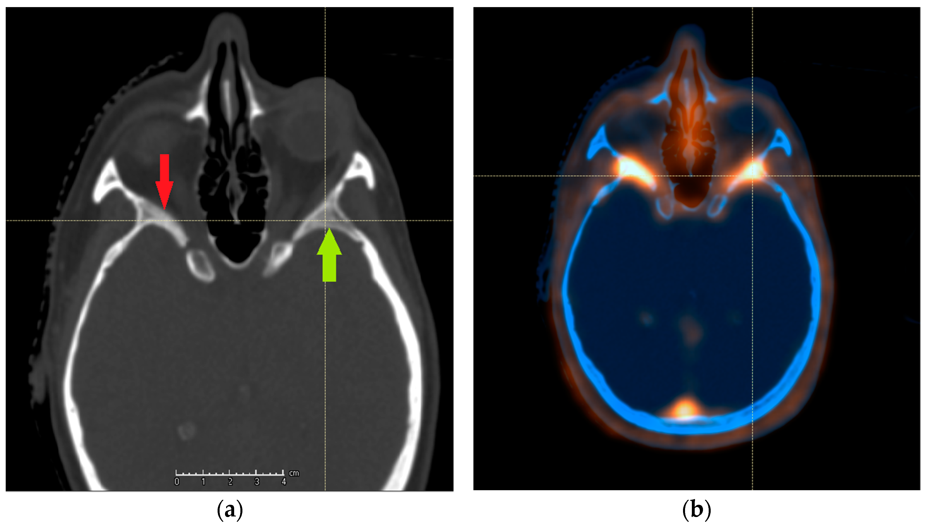 Cancers 13 04707 g001