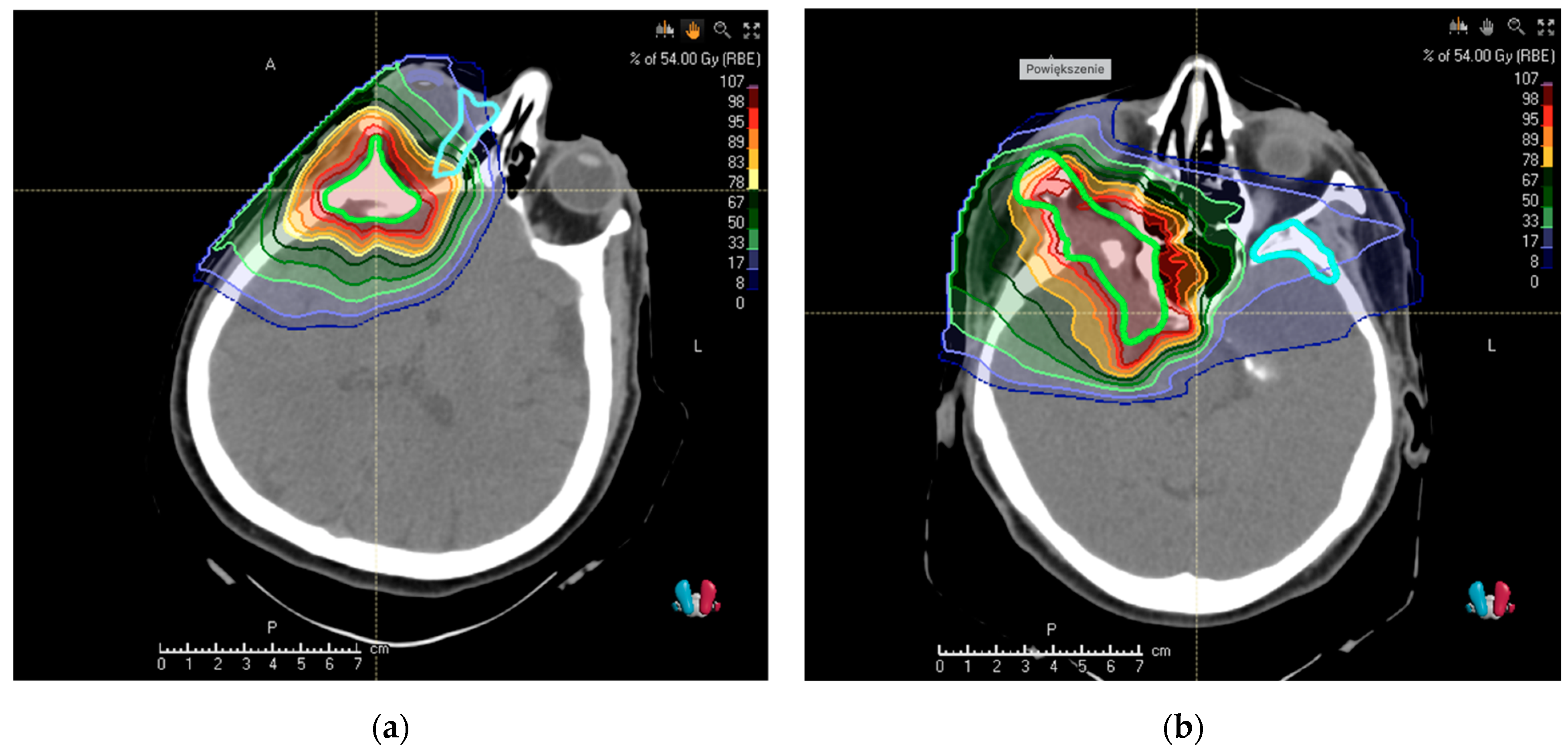 Cancers 13 04707 g002