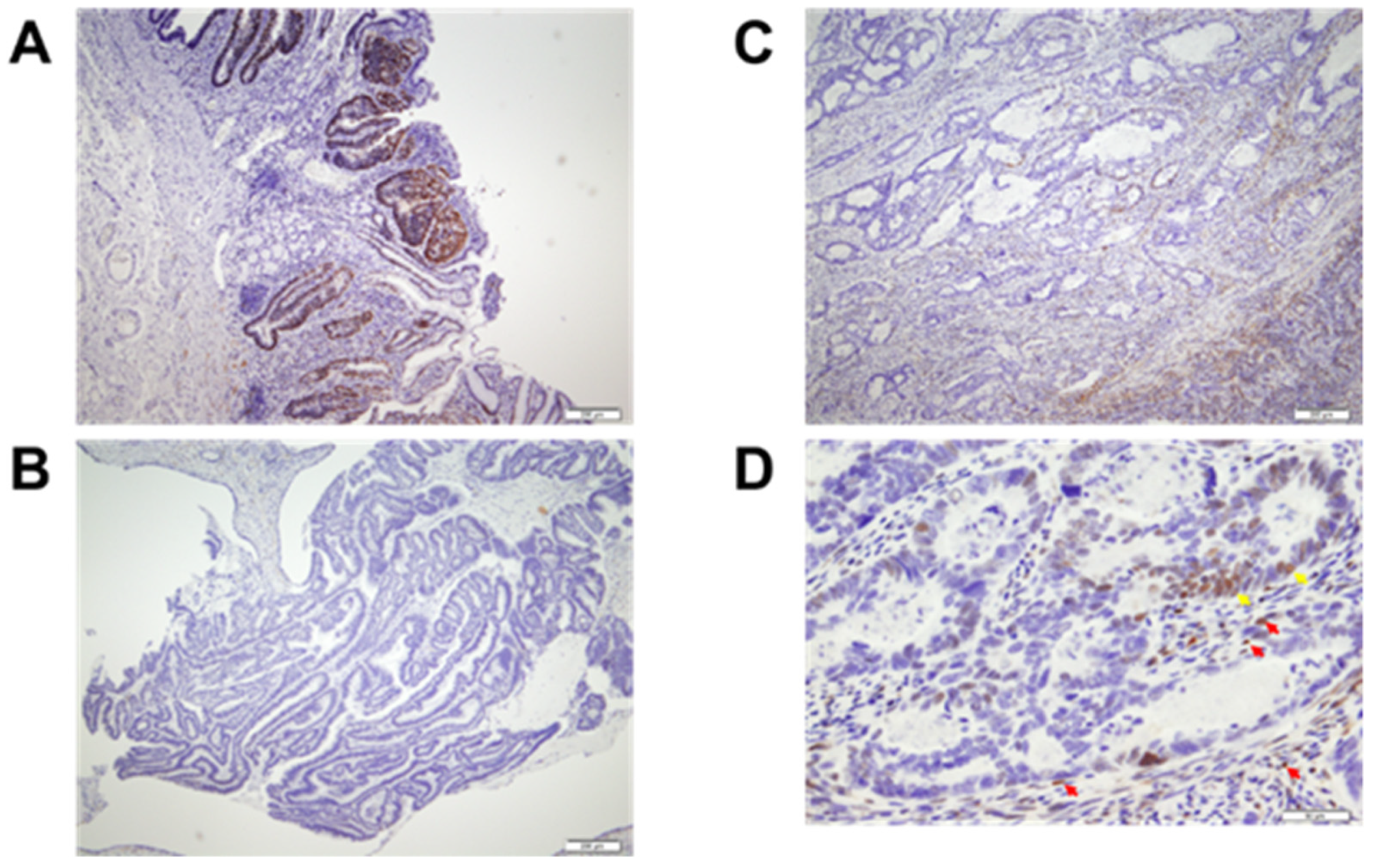 Cancers 13 04708 g002