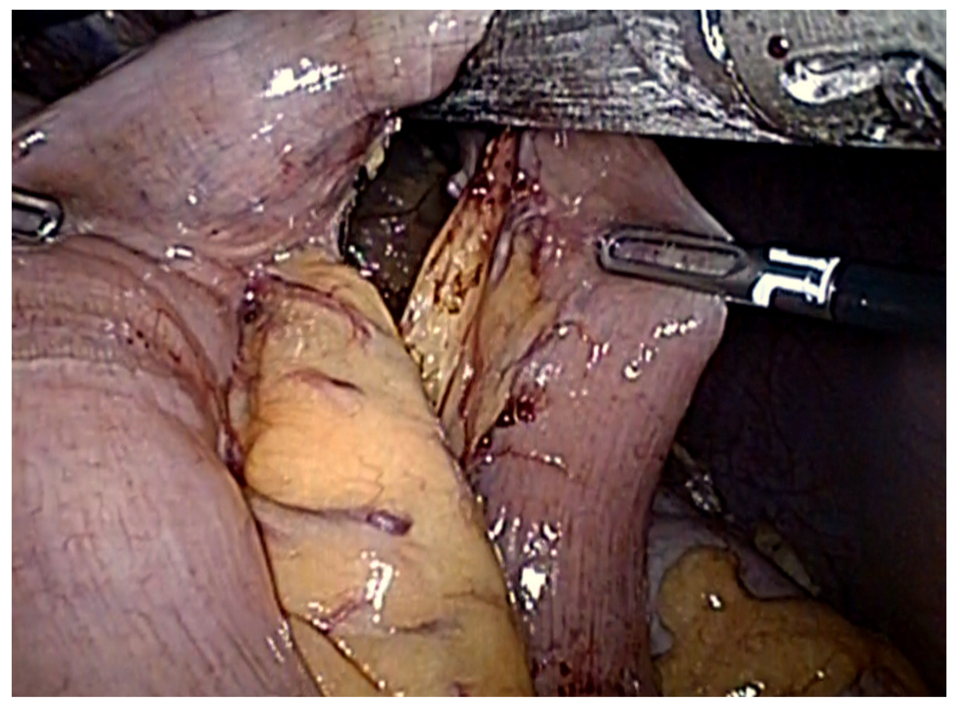 Cancers 13 04709 g003