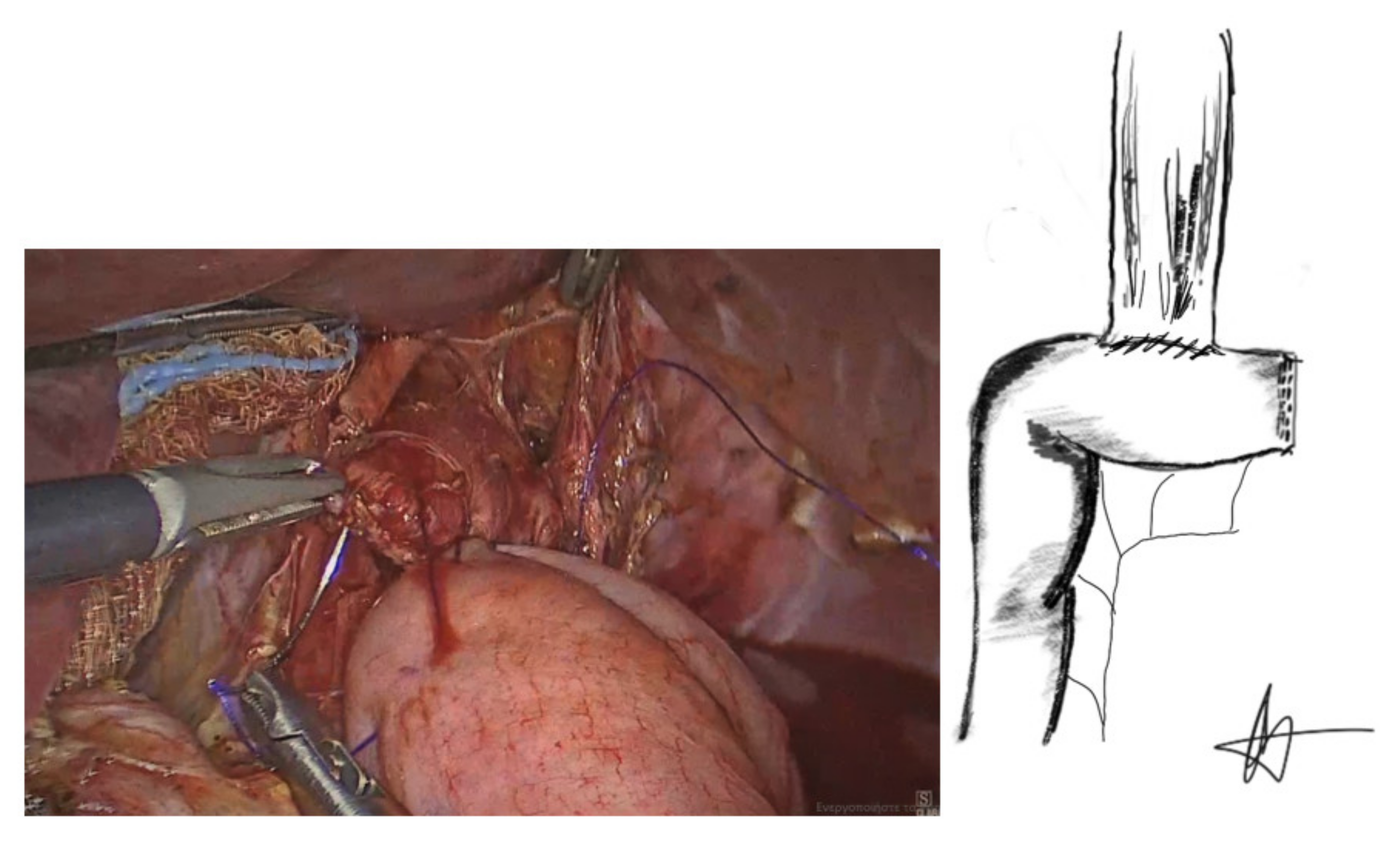 Cancers 13 04709 g004