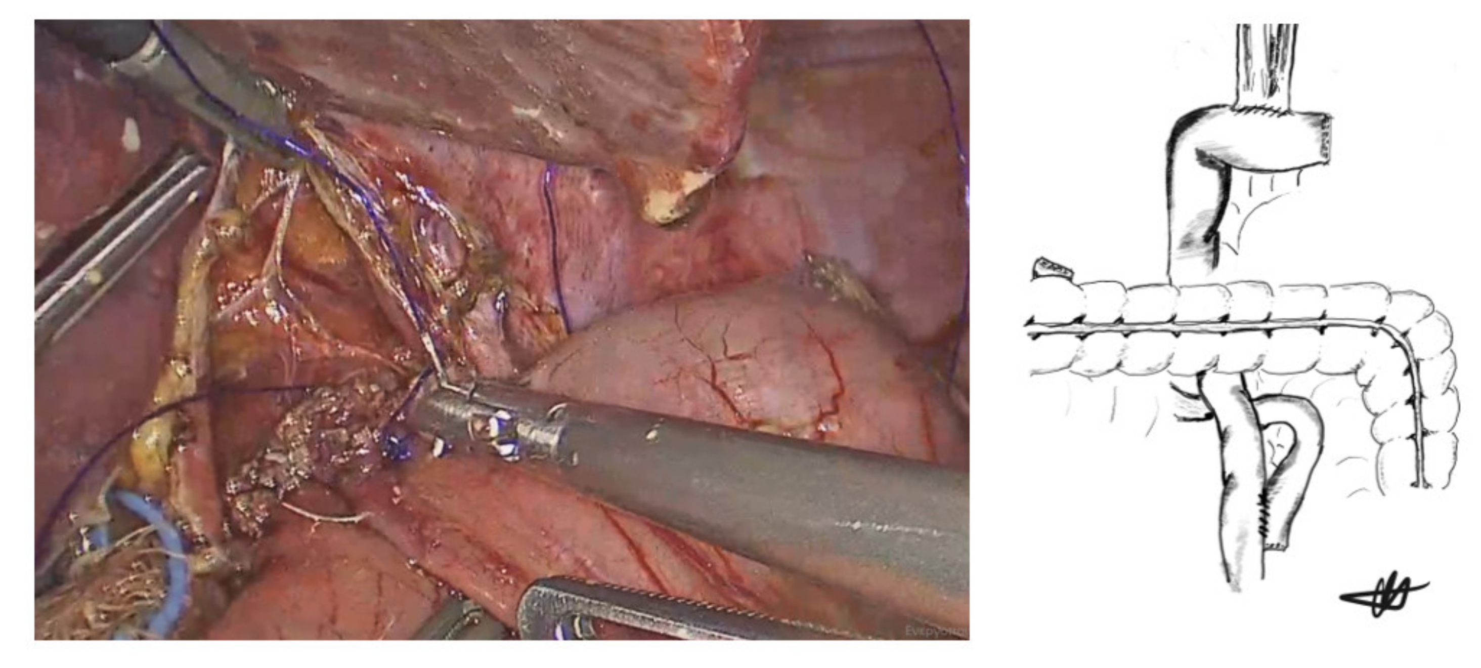 Cancers 13 04709 g006