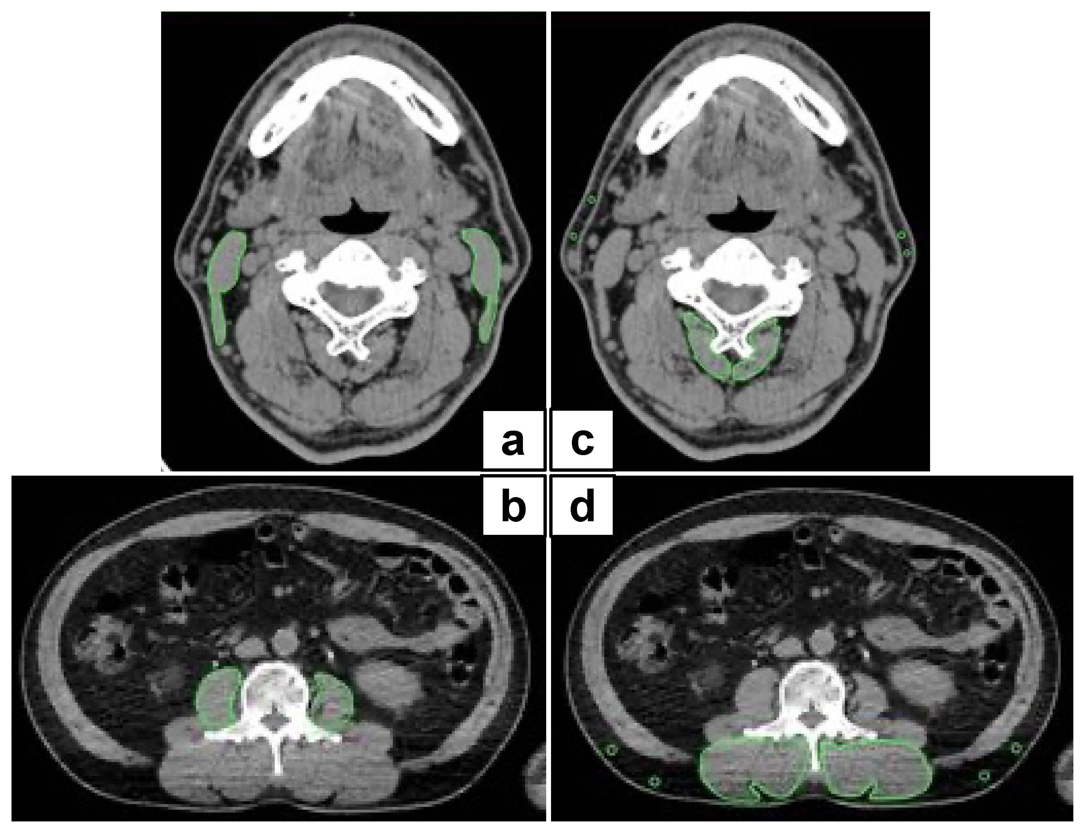 Cancers 13 04725 g001