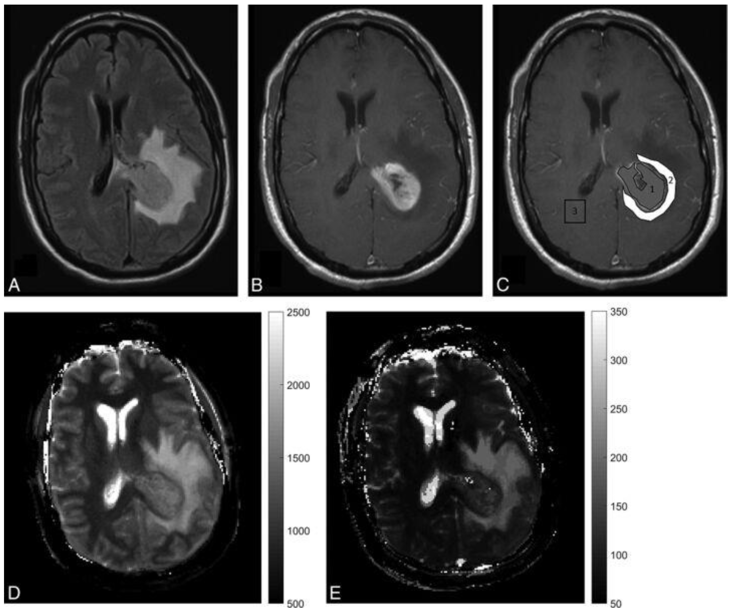 Cancers 13 04742 g003 Cancers 13 04742 g003