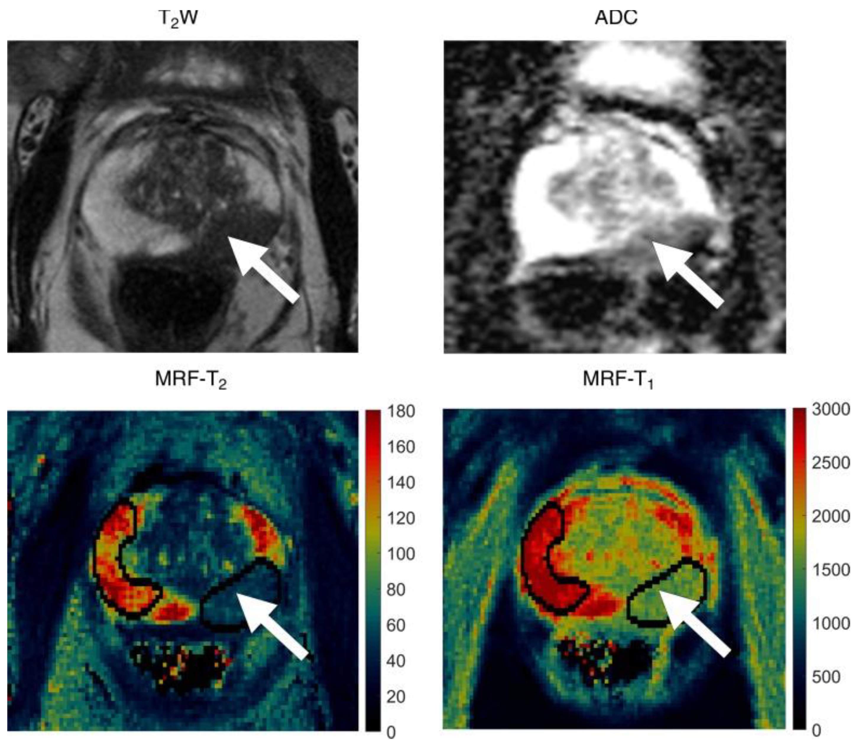 Cancers 13 04742 g004 Cancers 13 04742 g004