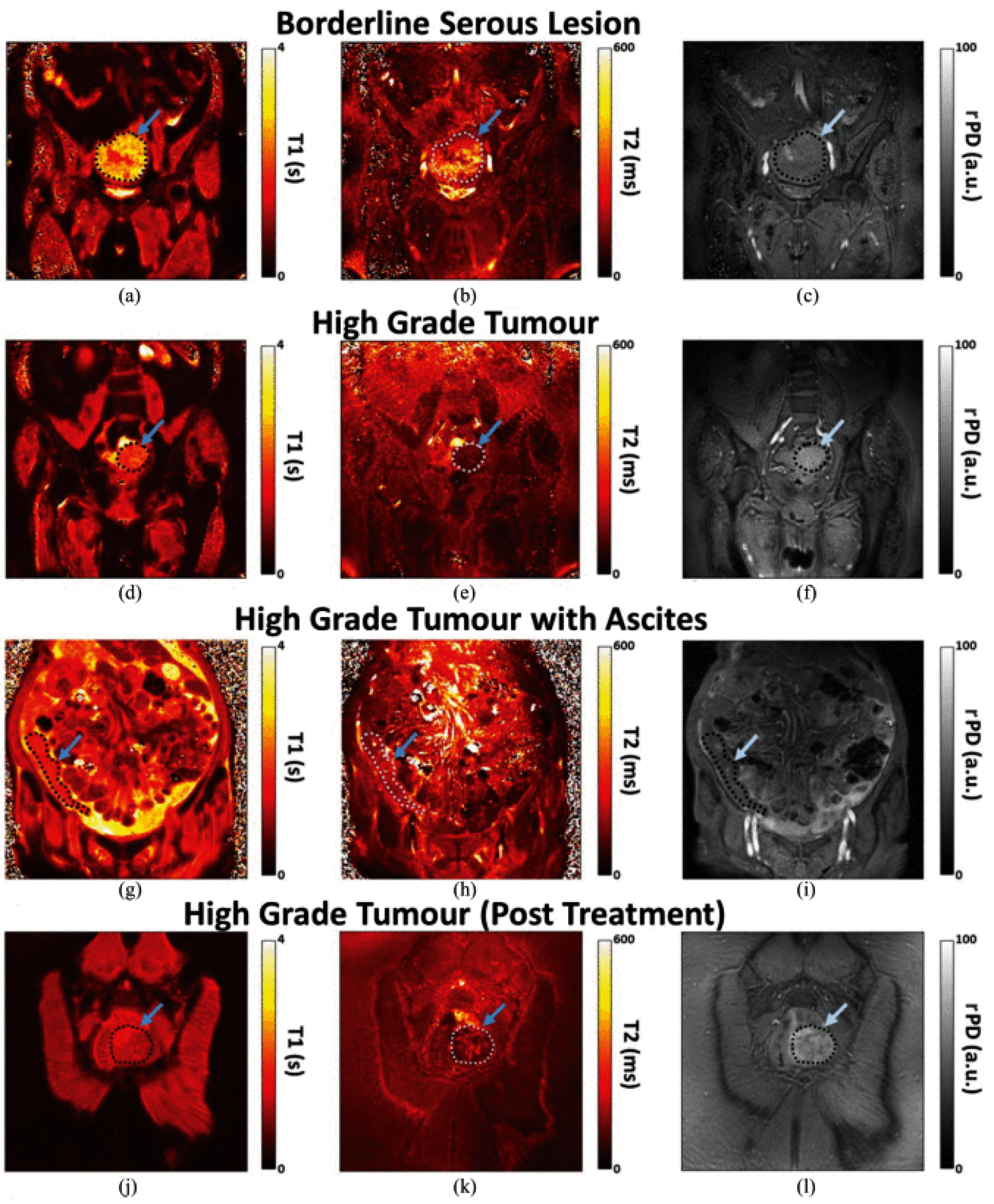 Cancers 13 04742 g005 Cancers 13 04742 g005
