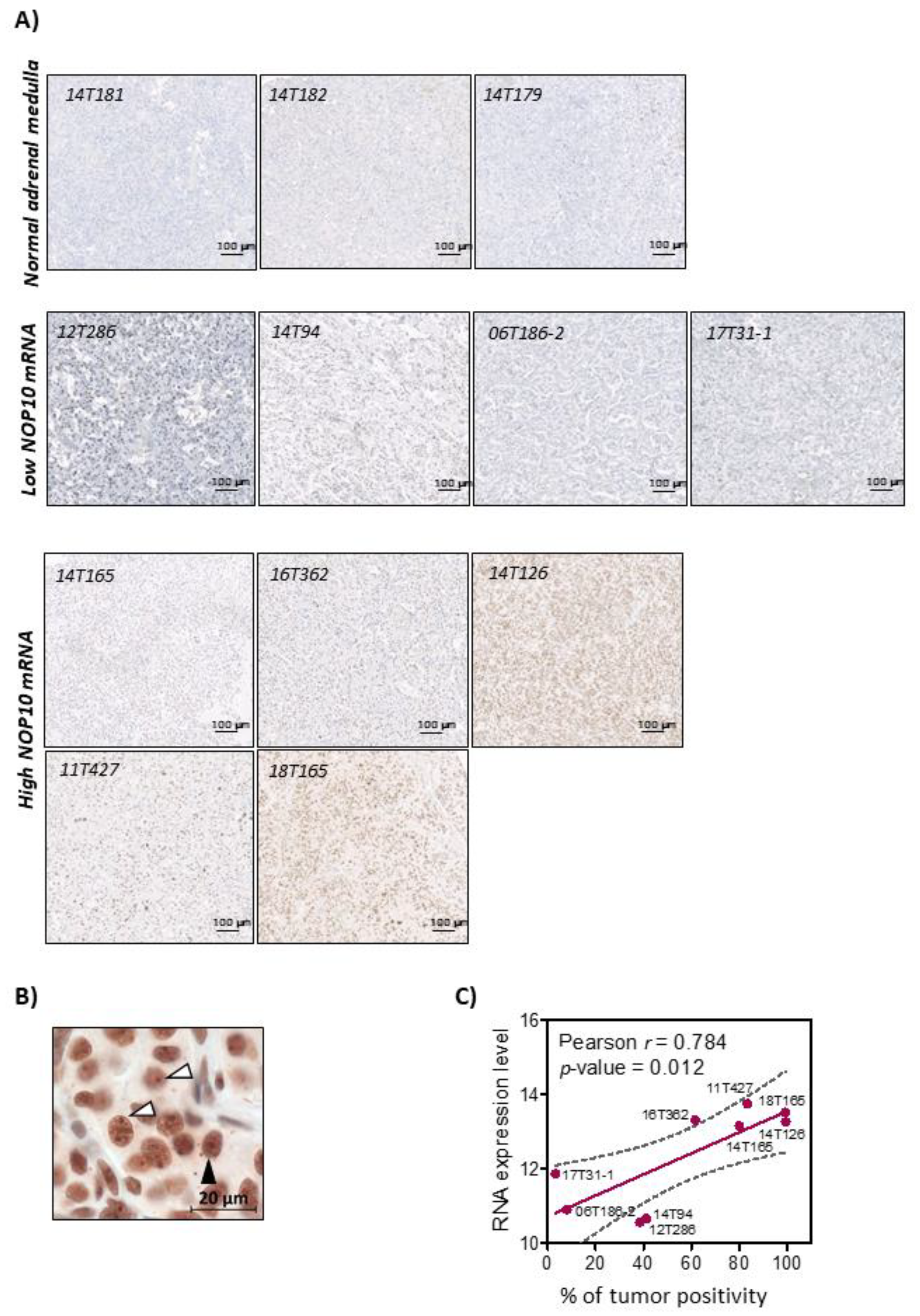 Cancers 13 04758 g003