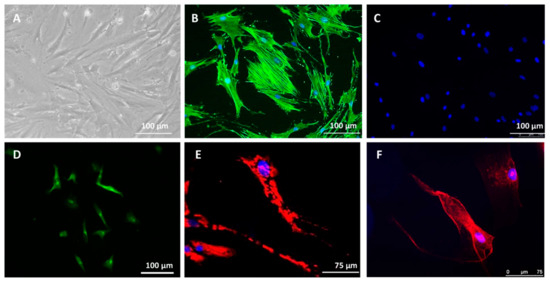 Cancers 13 04761 g0a1 550