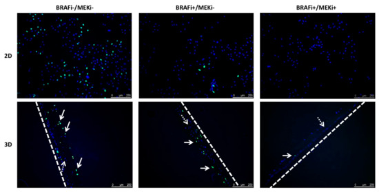 Cancers 13 04761 g0a3 550