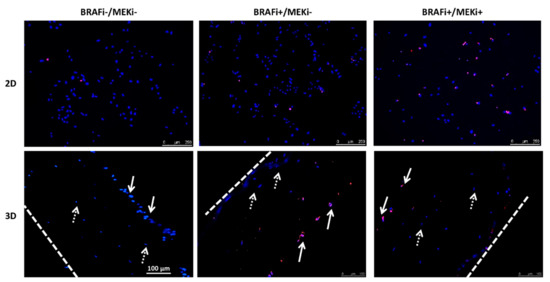 Cancers 13 04761 g0a4 550