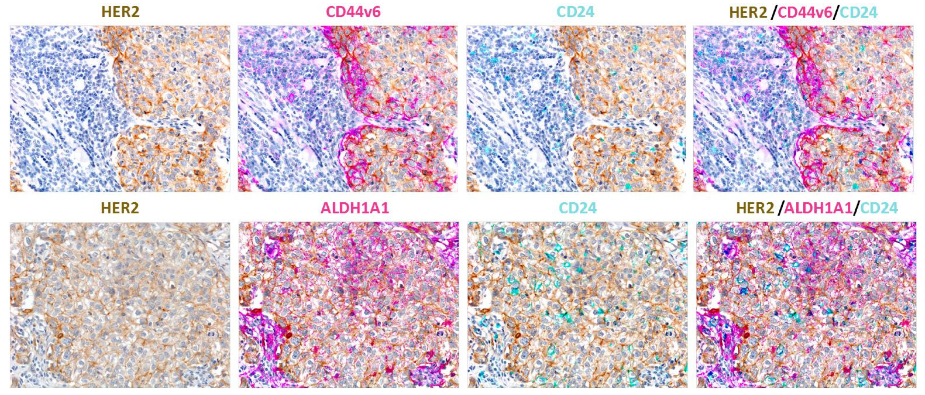 Cancers 13 04778 g002