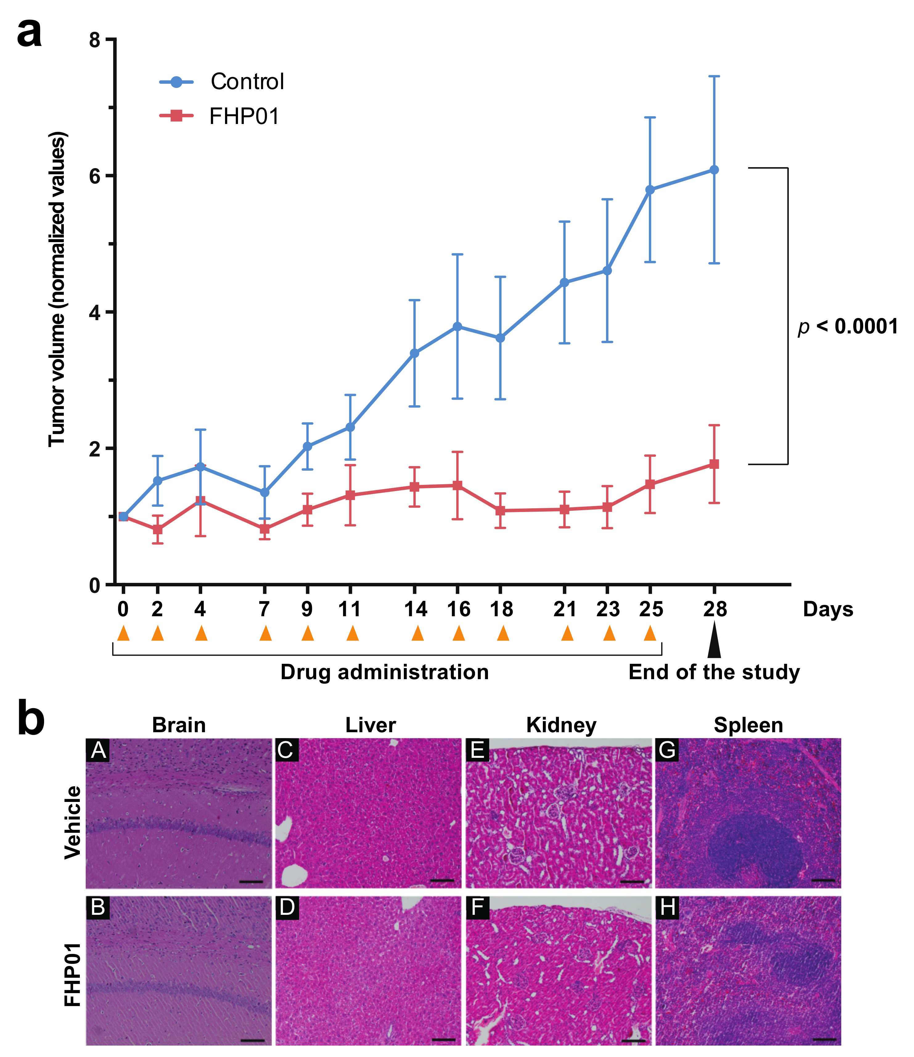 Cancers 13 04830 g004
